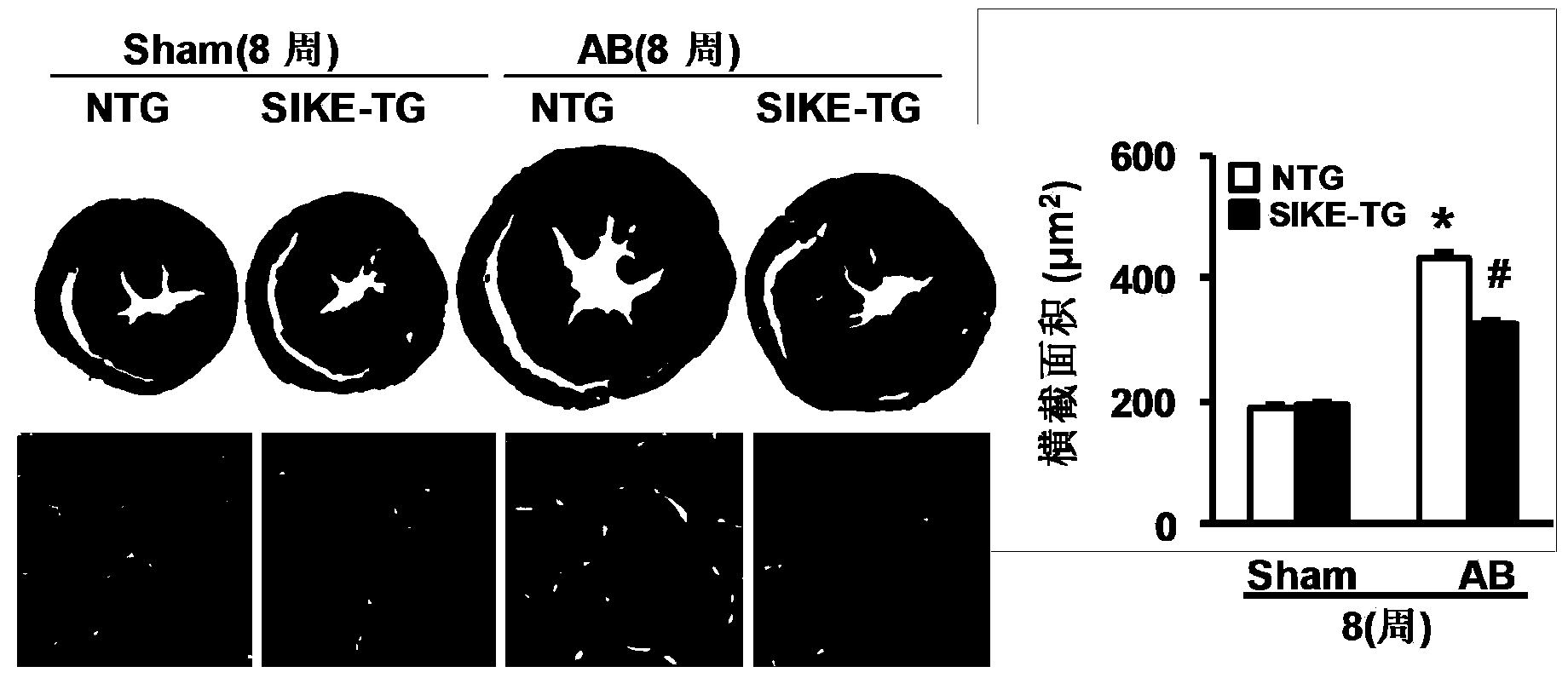 Function and application of IkB kinase epsilon inhibitor (SIKE) in treating cardiac hypertrophy