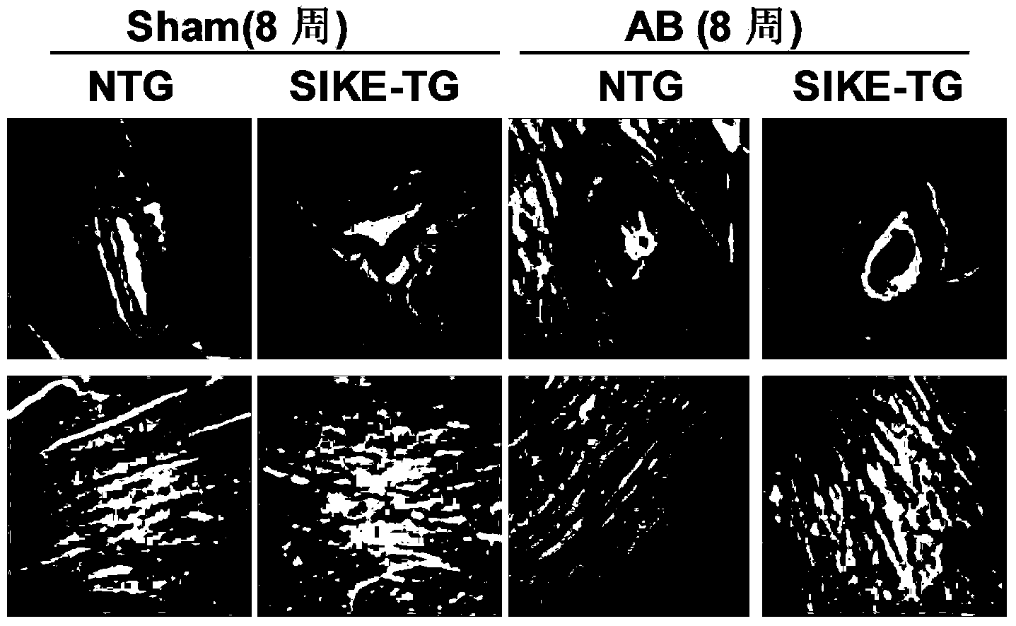 Function and application of IkB kinase epsilon inhibitor (SIKE) in treating cardiac hypertrophy