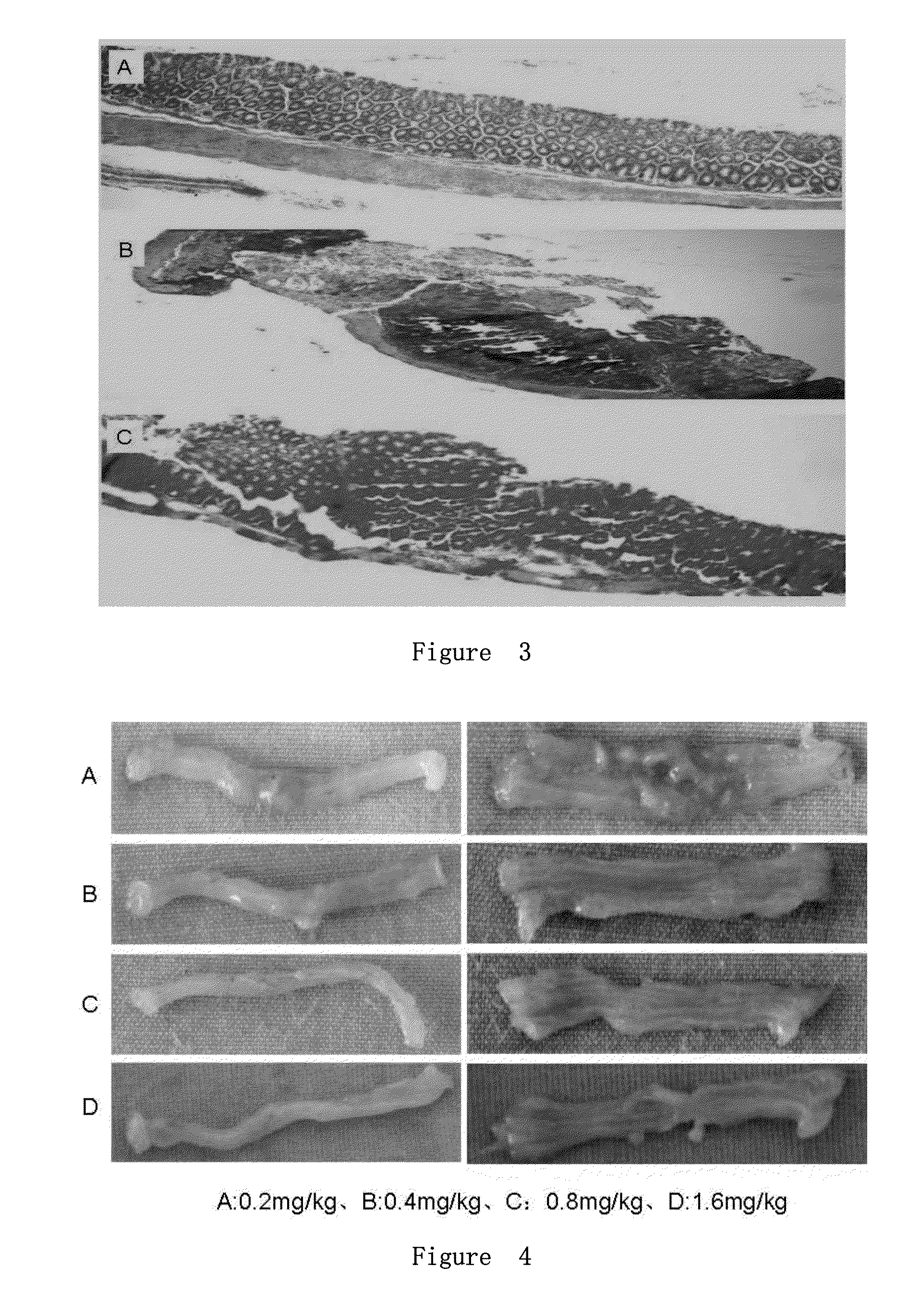 Use of salmonella flagellin derivative in preparation of drug for preventing and treating inflammatory bowel diseases