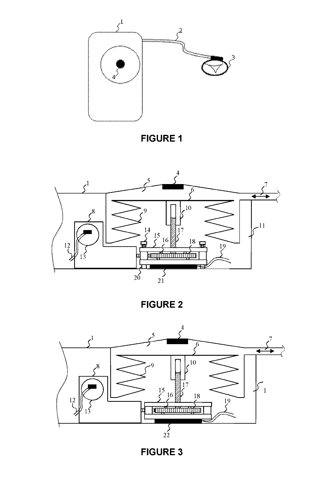 Implantable occlusion system