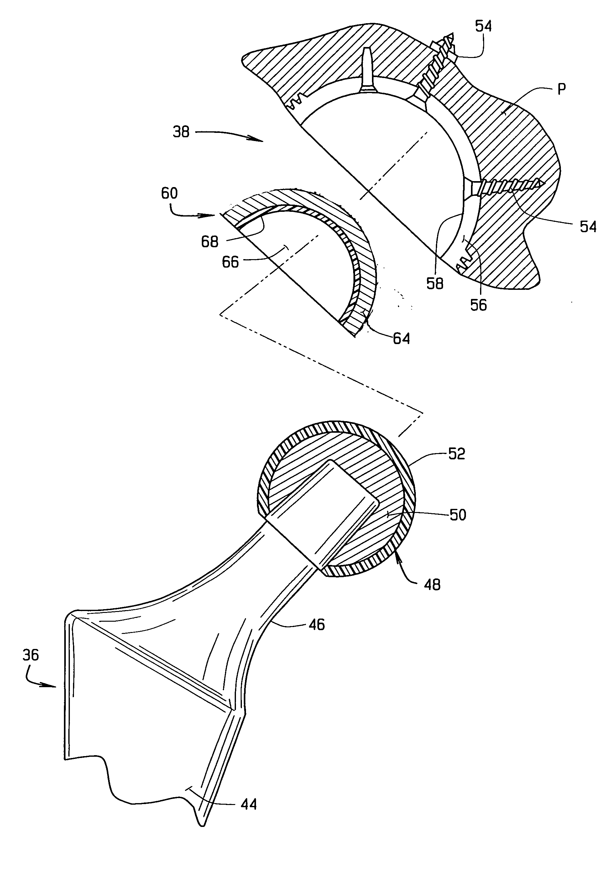 Coated ceramic total joint arthroplasty and method of making same