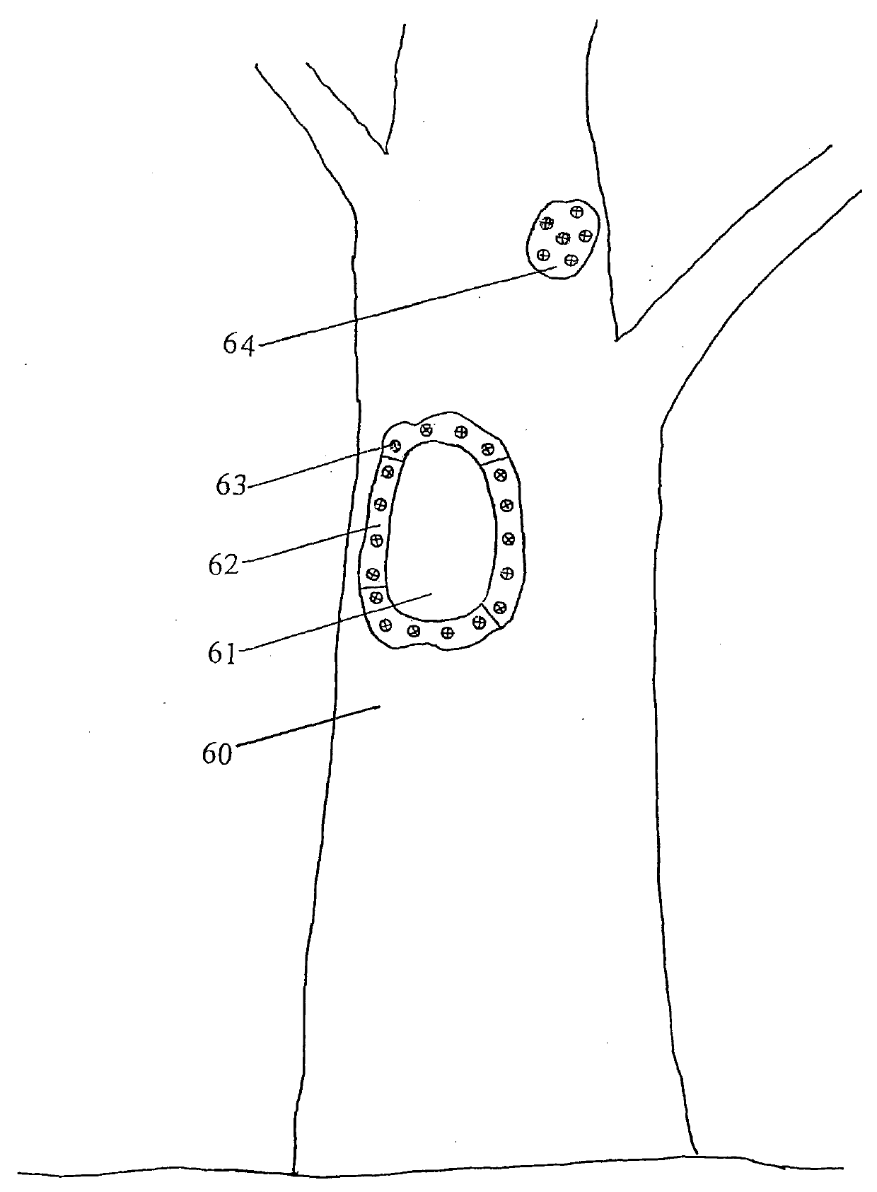 Method for repairing tree hole by manufacturing plastic thermal expansion bucket through moving type extruder and pouring cement