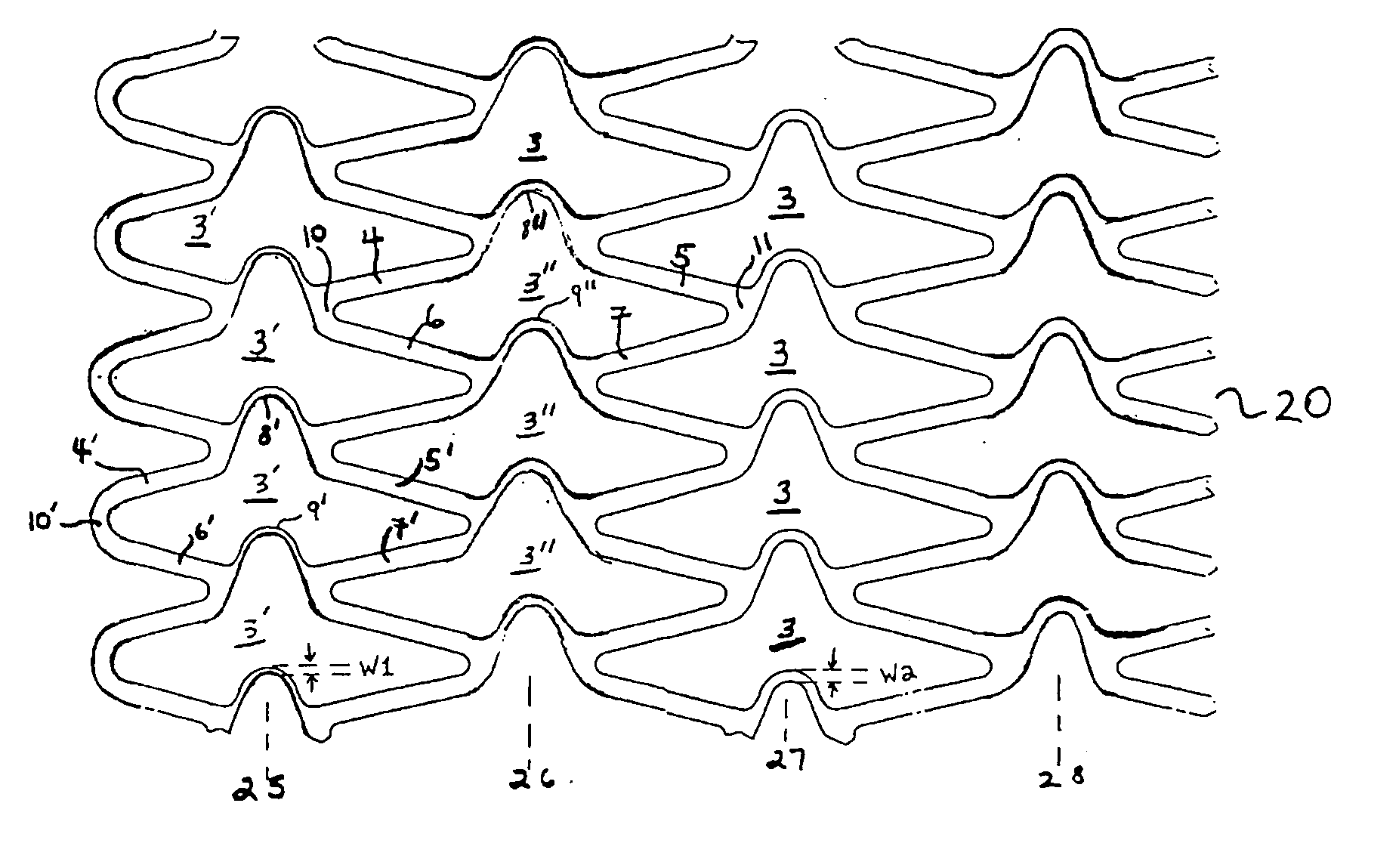 Stent with variable features to optimize support and method of making such stent