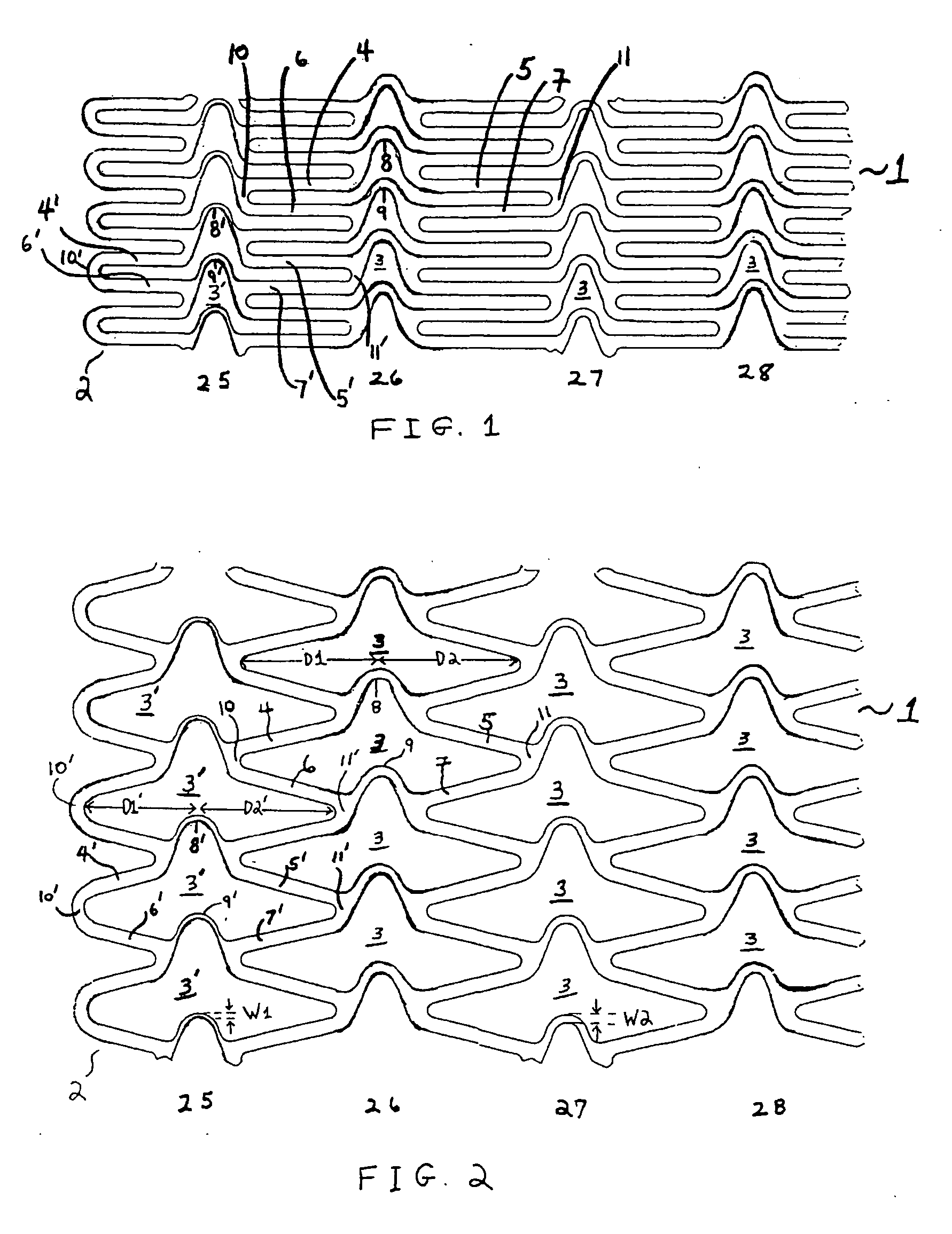 Stent with variable features to optimize support and method of making such stent