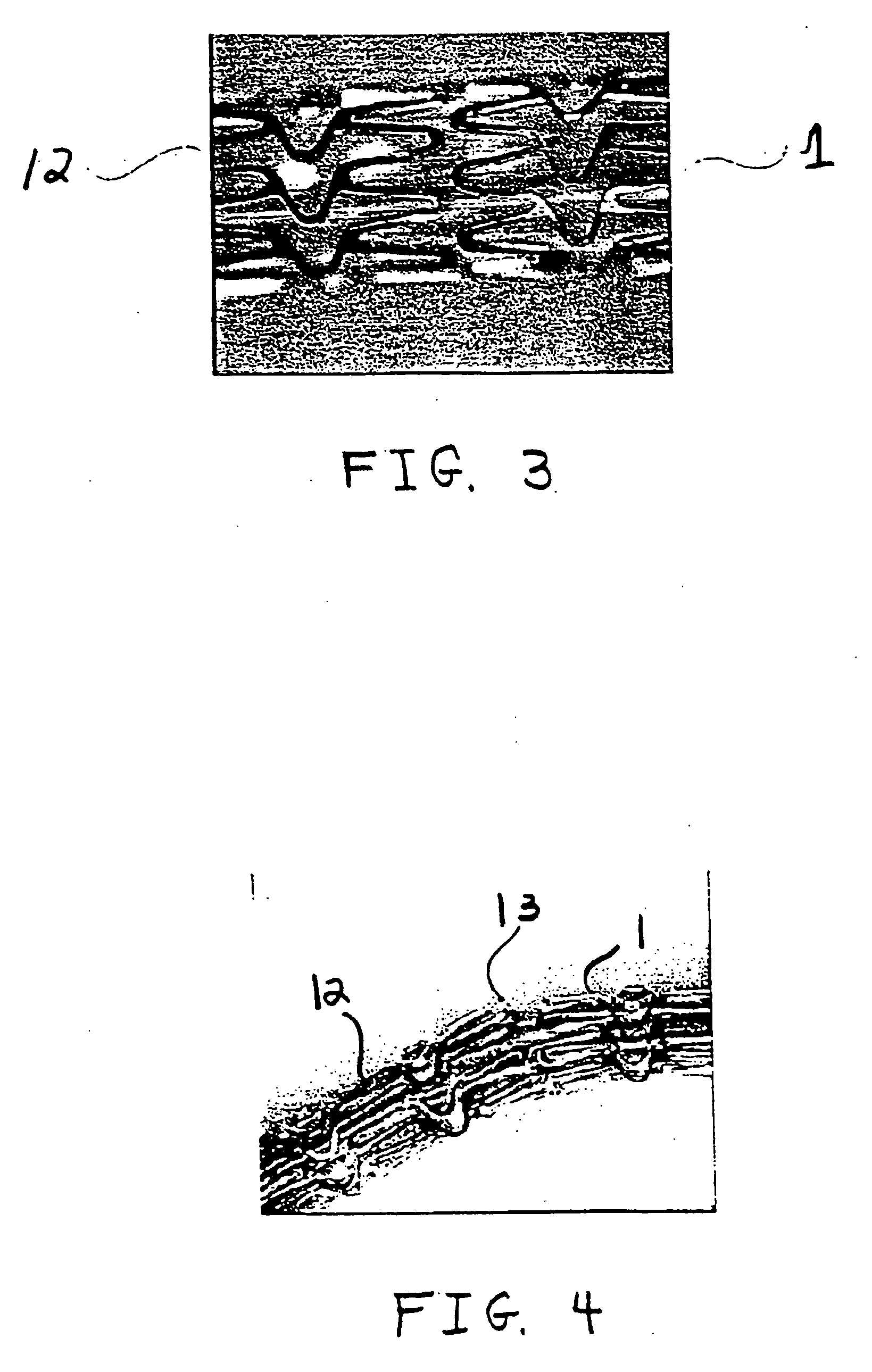 Stent with variable features to optimize support and method of making such stent