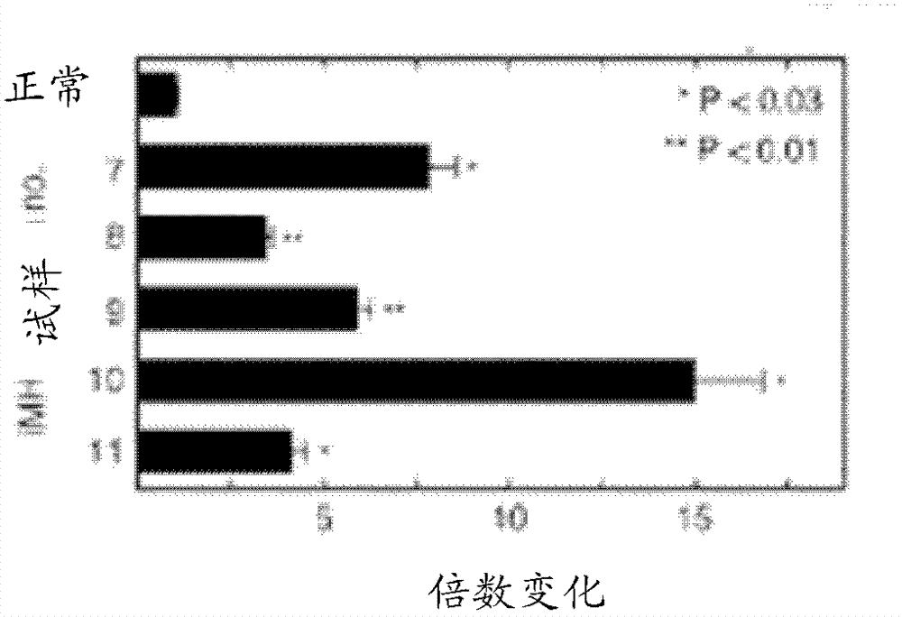 Kit and method for detecting porous dental hydroxy apatite