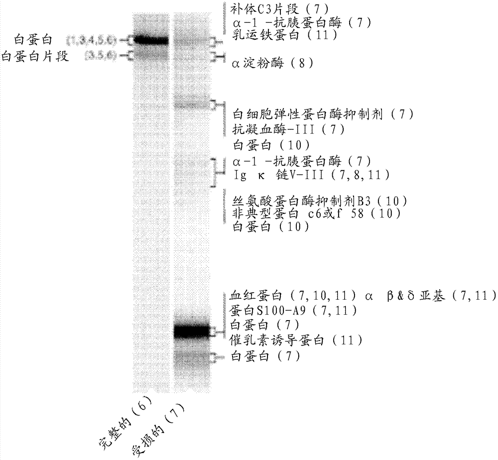 Kit and method for detecting porous dental hydroxy apatite