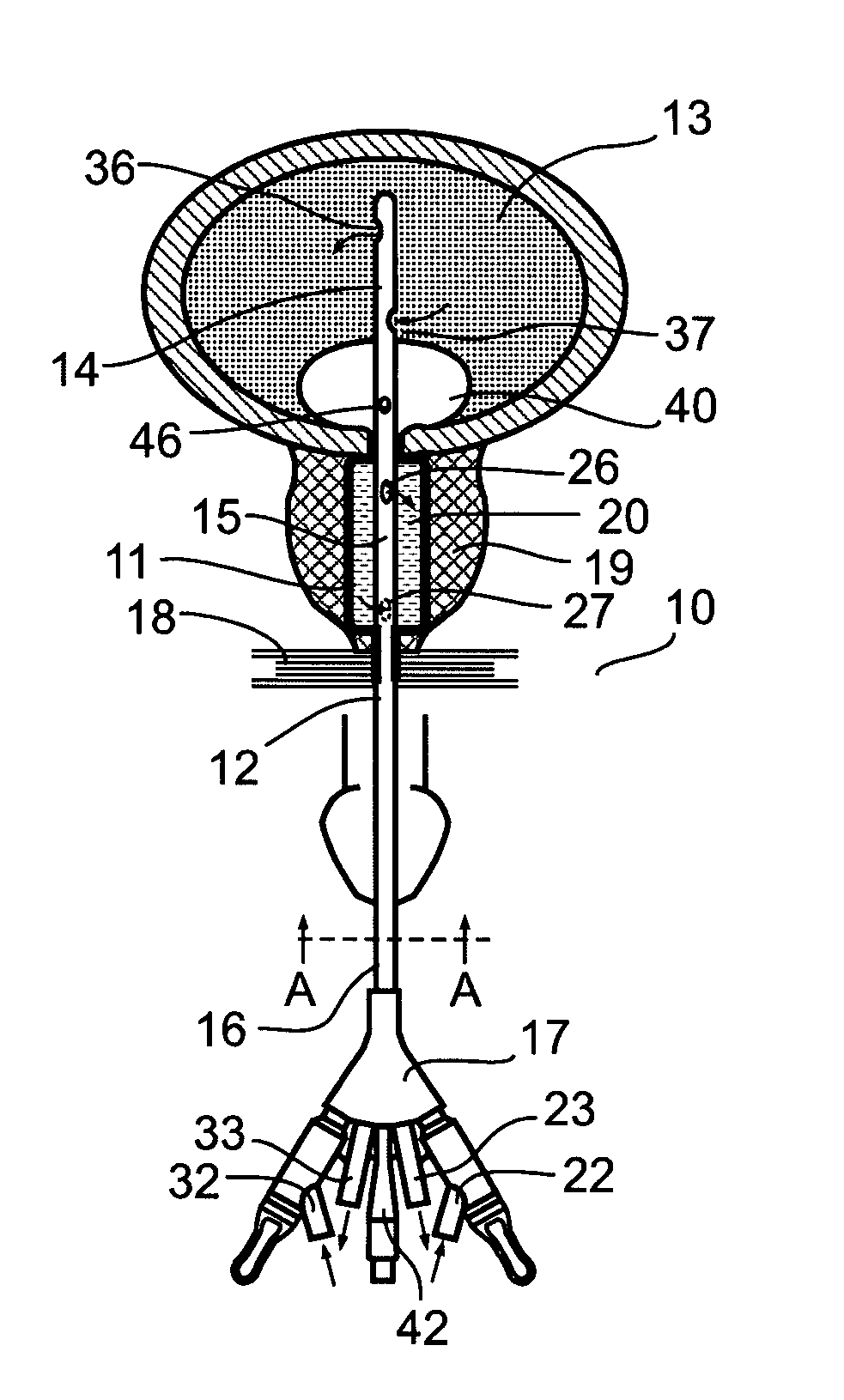 System and method for treating urinary tract disorders