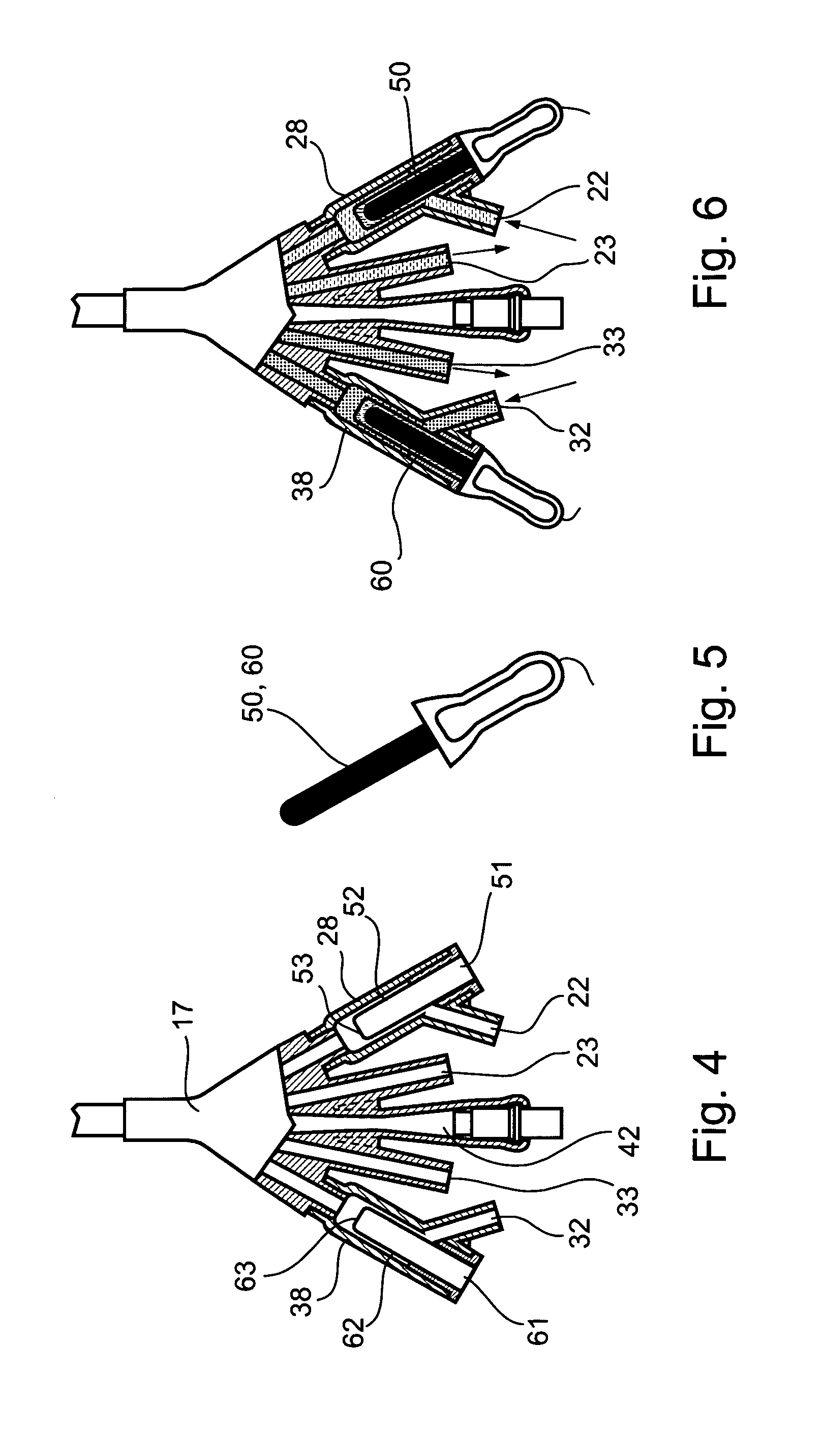 System and method for treating urinary tract disorders