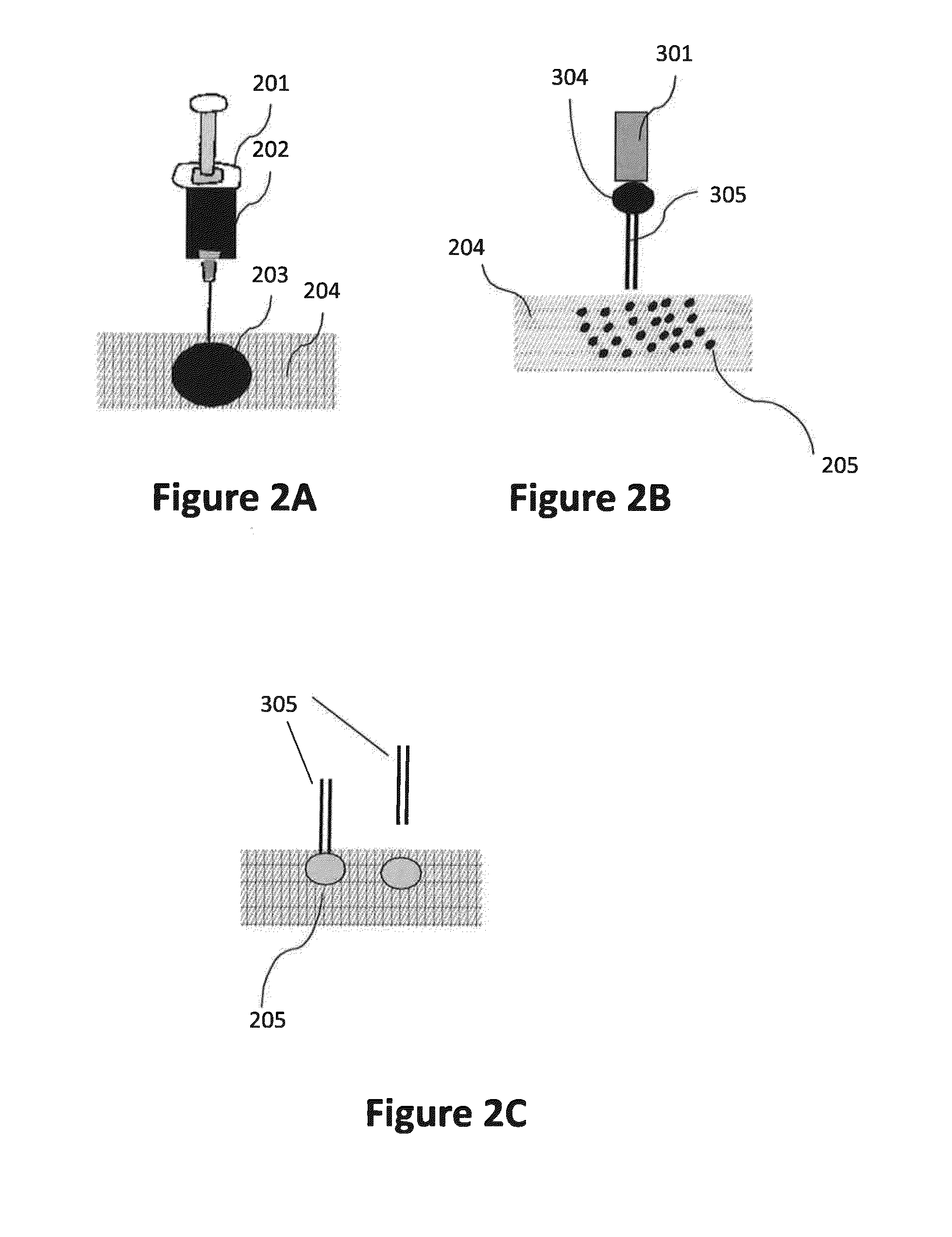 Compositions, methods and devices for local drug delivery