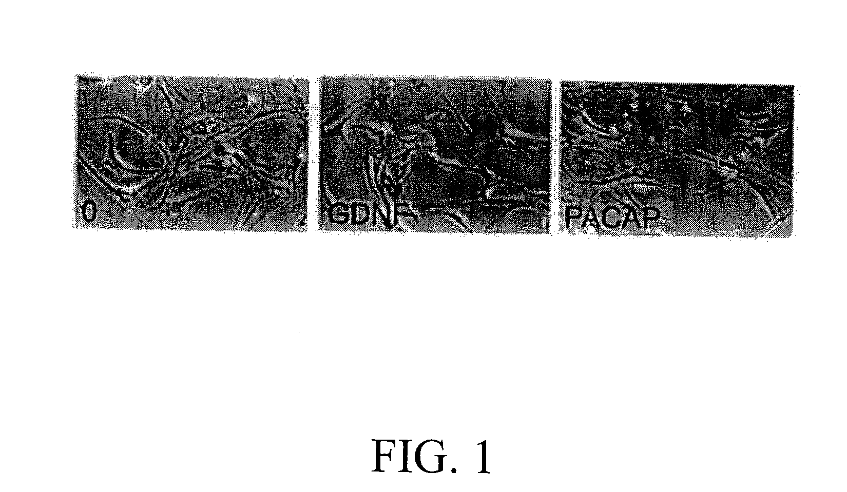 Method for inducing neural differentiation