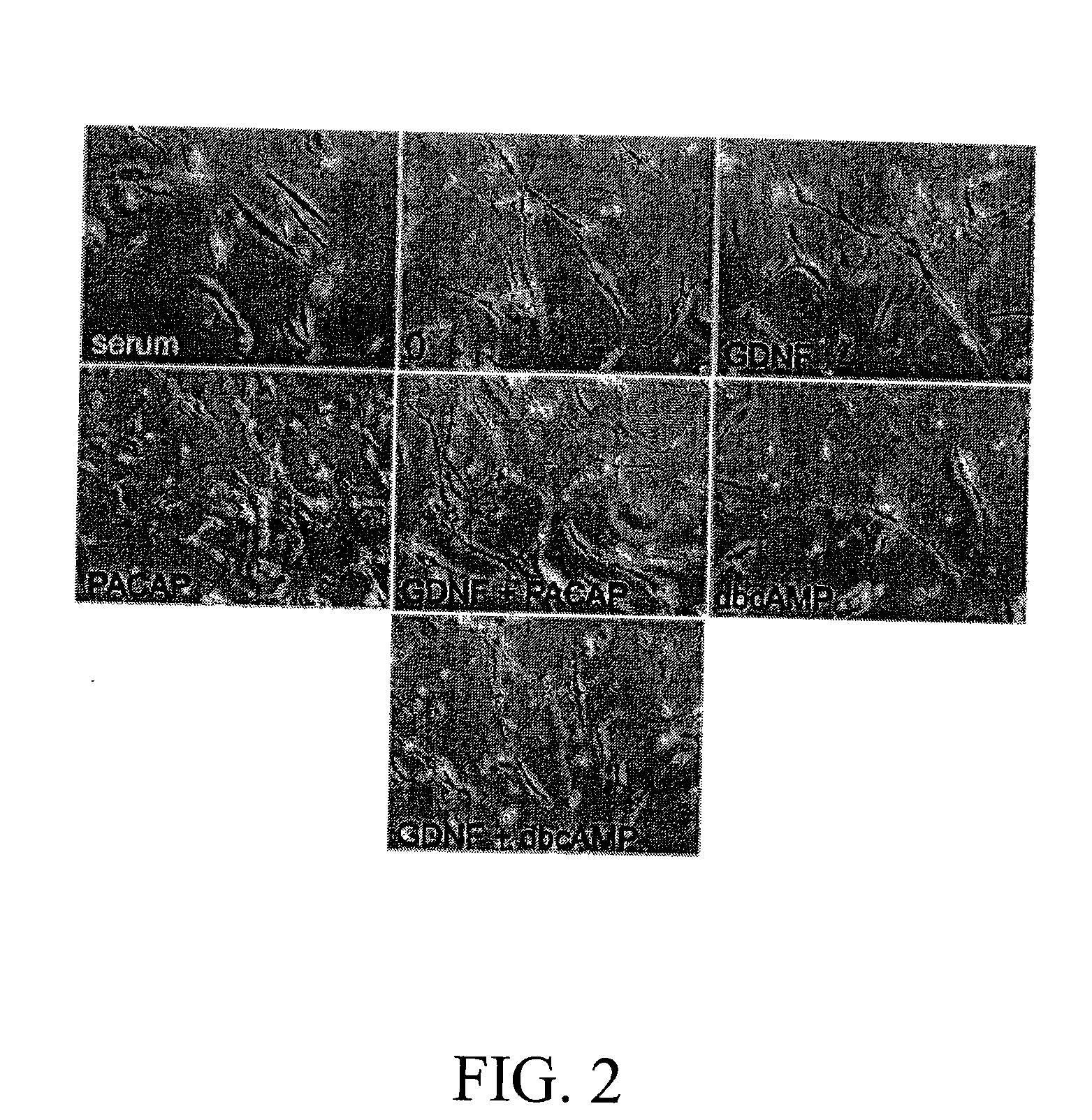 Method for inducing neural differentiation