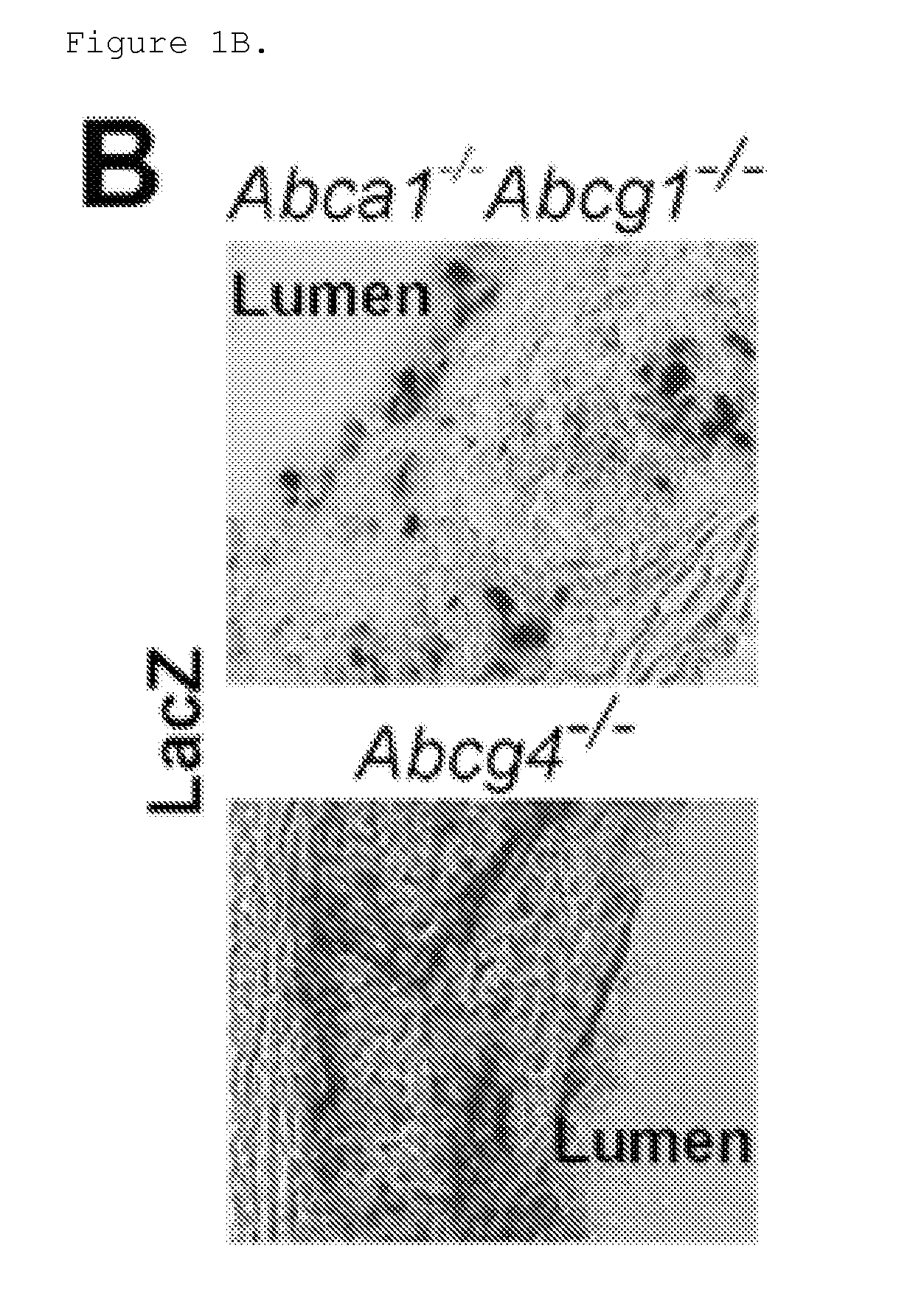 Methods of treating atherosclerosis or myeloproliferative neoplasms by administering a LYN kinase activator