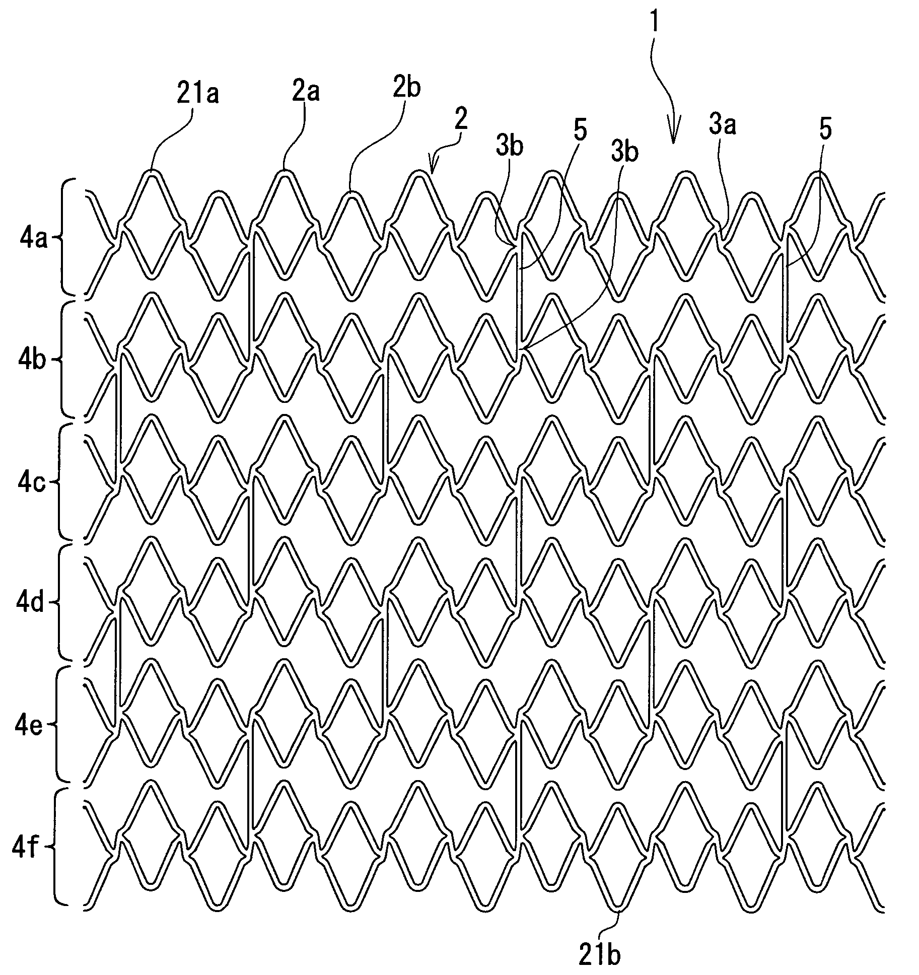 Indwelling stent and living organ dilator