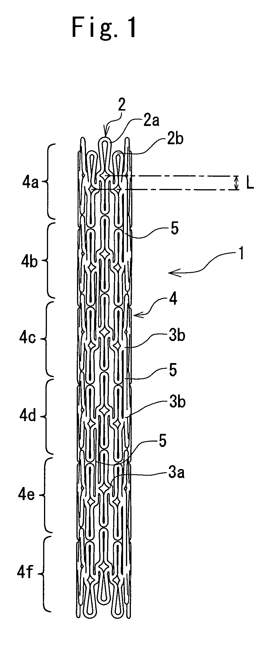 Indwelling stent and living organ dilator