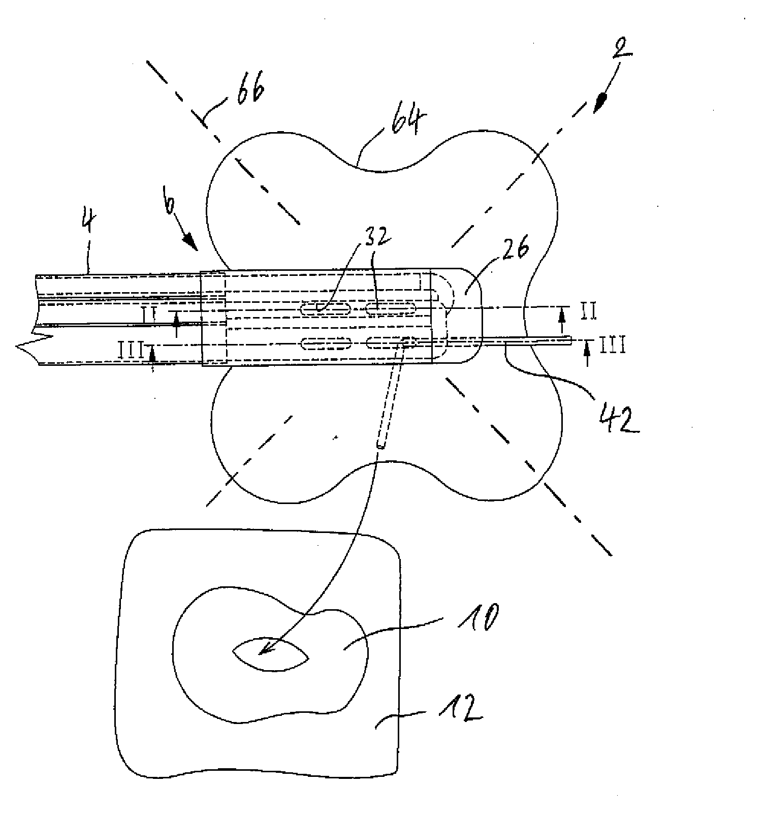 Connection device for use in the negative pressure treatment of wounds