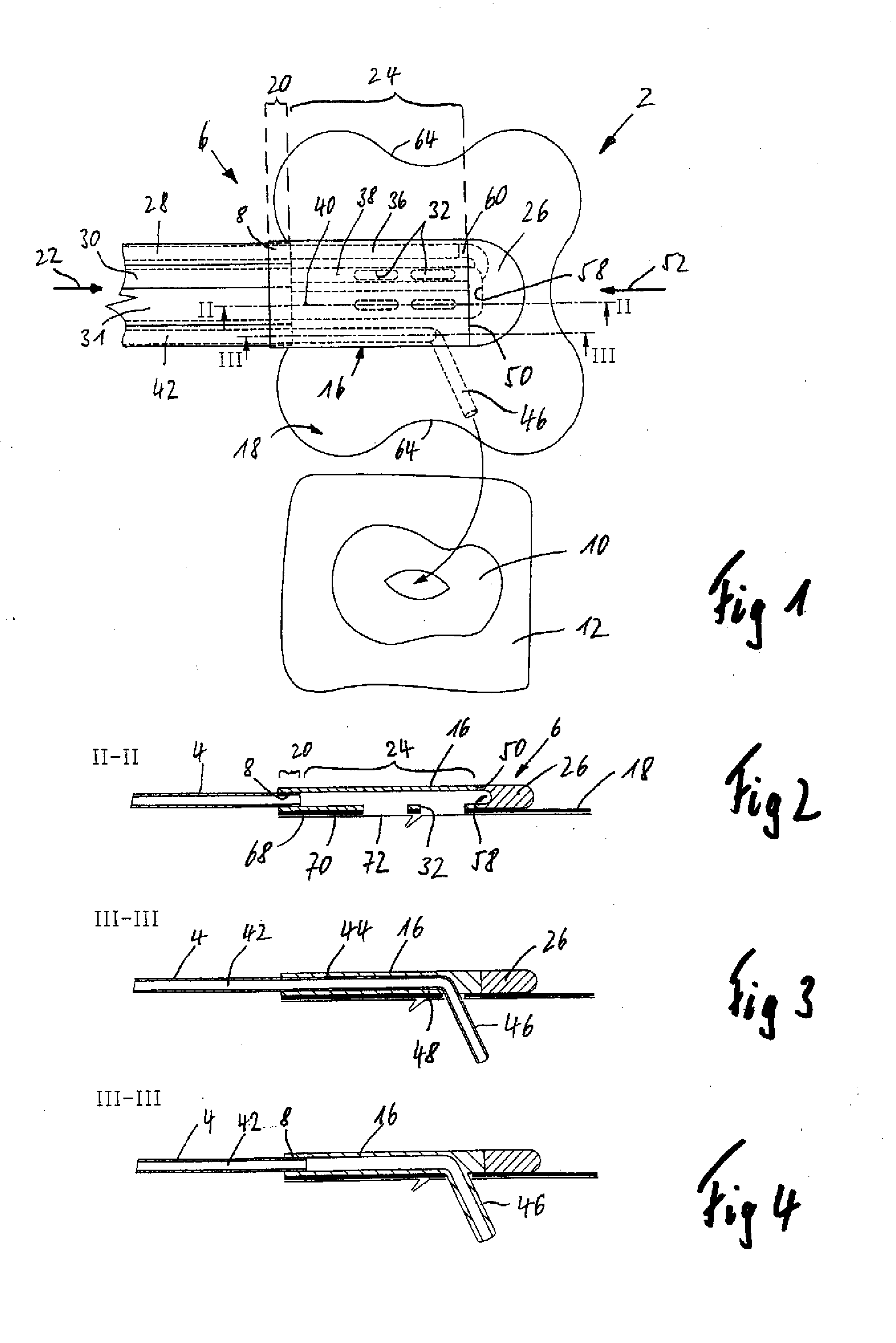 Connection device for use in the negative pressure treatment of wounds