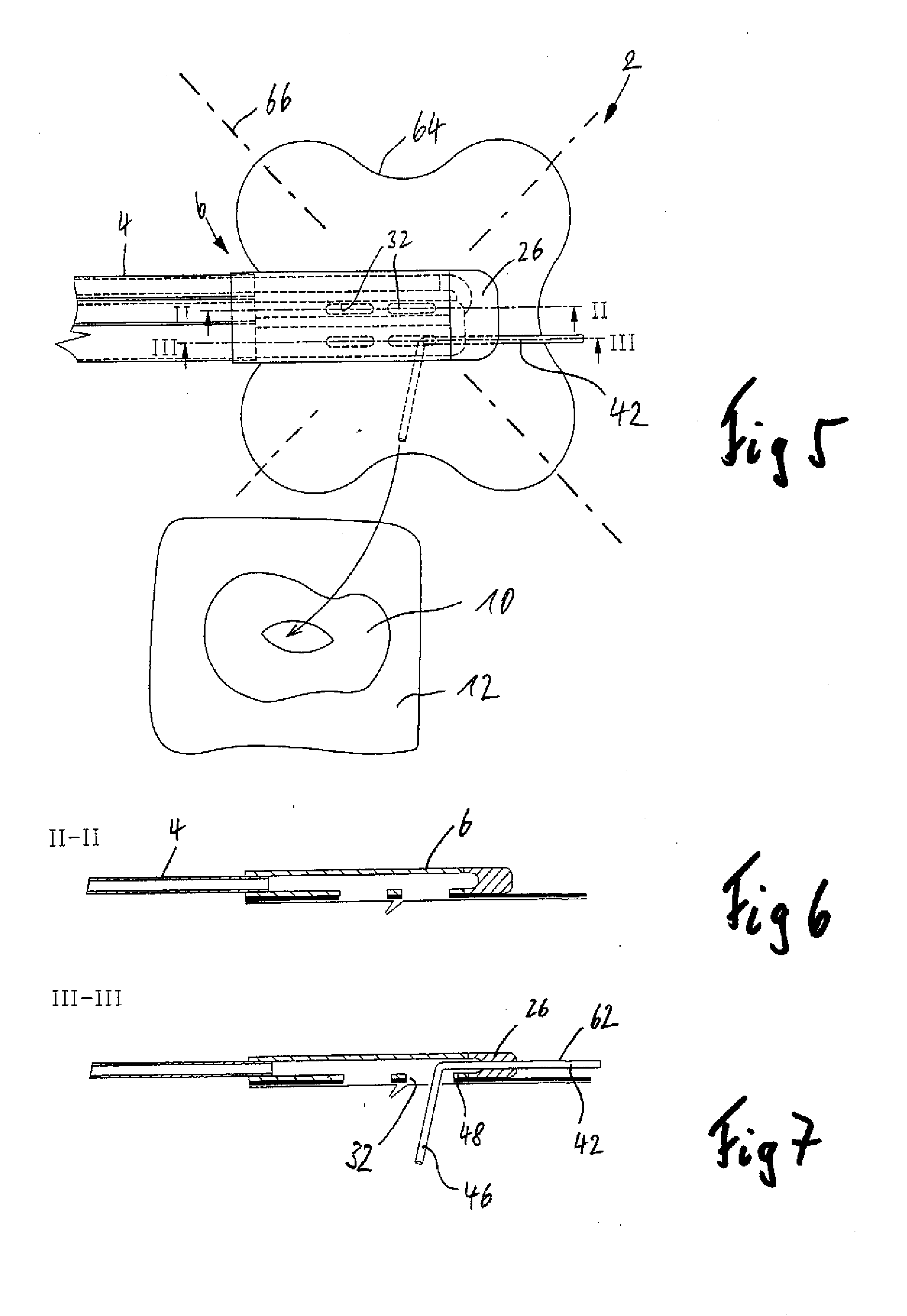 Connection device for use in the negative pressure treatment of wounds