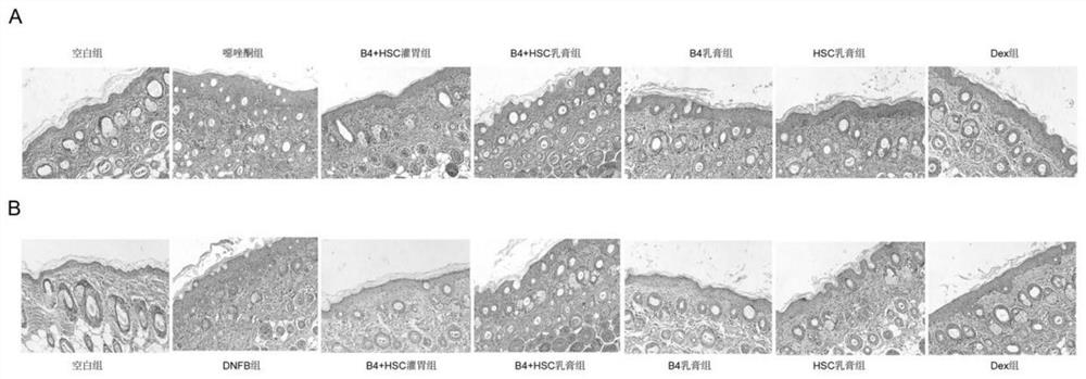 Pulsatilla saponin composition and application thereof in preparation of medicine for treating skin diseases