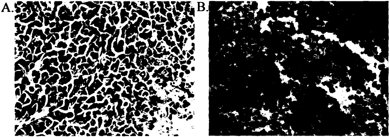 Tracer for derivative based on GnRH polypeptide as well as preparation method and application thereof