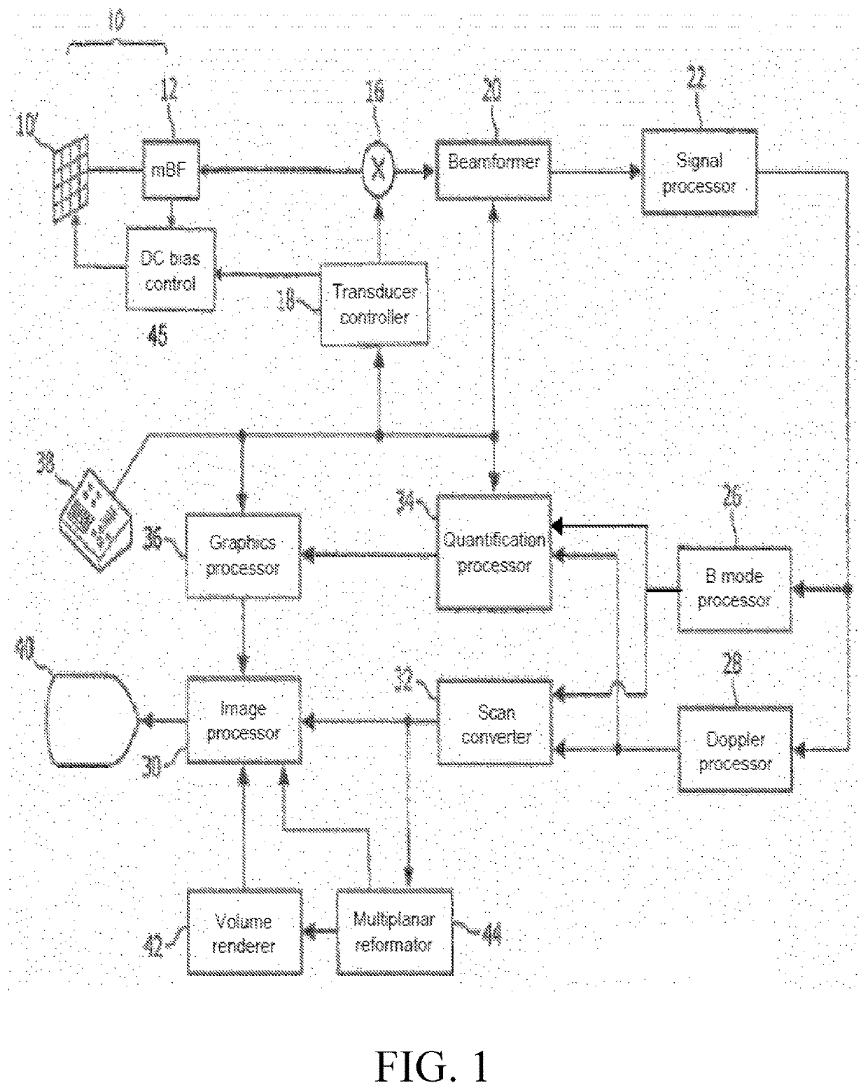 Ultrasound system and method of vessel identification