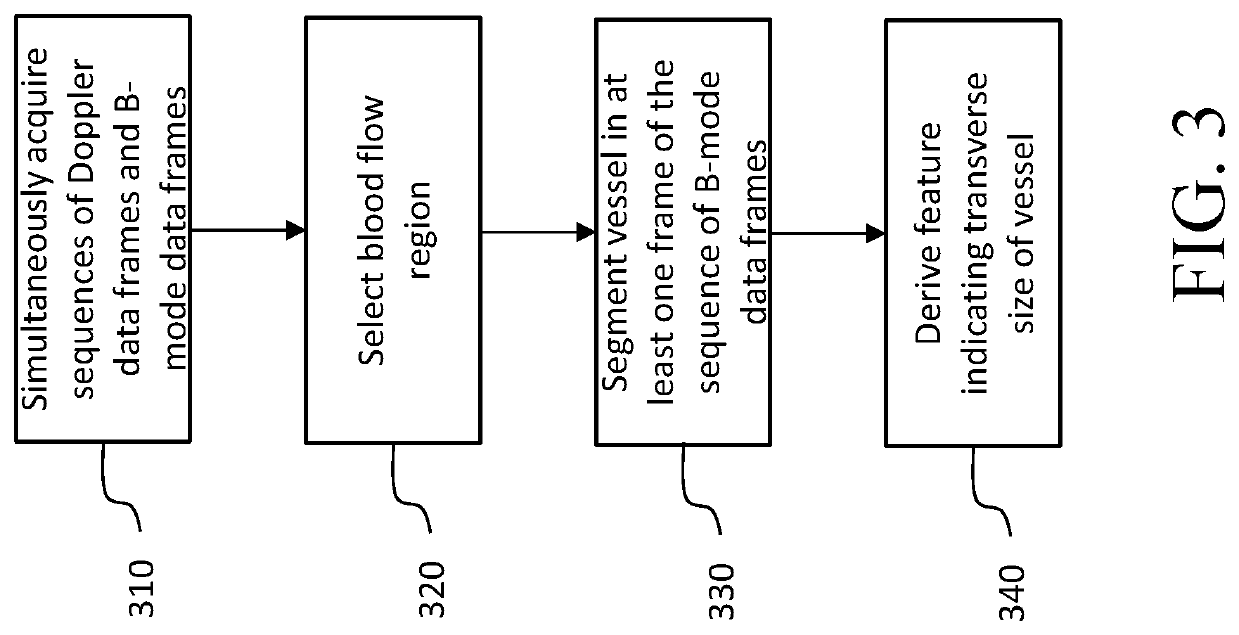 Ultrasound system and method of vessel identification