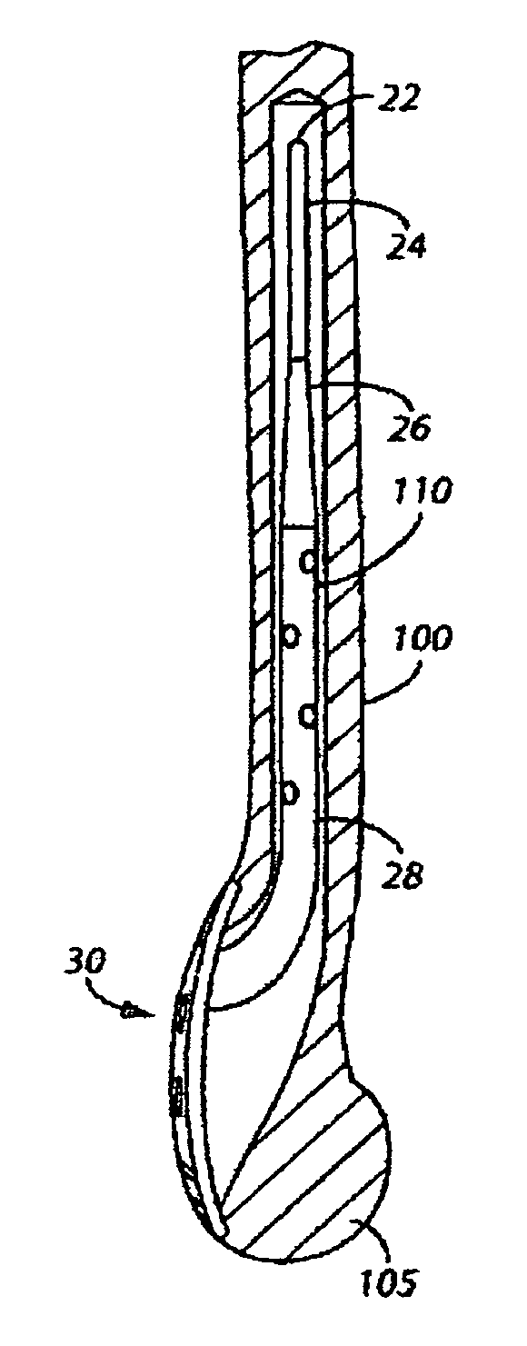 Fracture fixation system