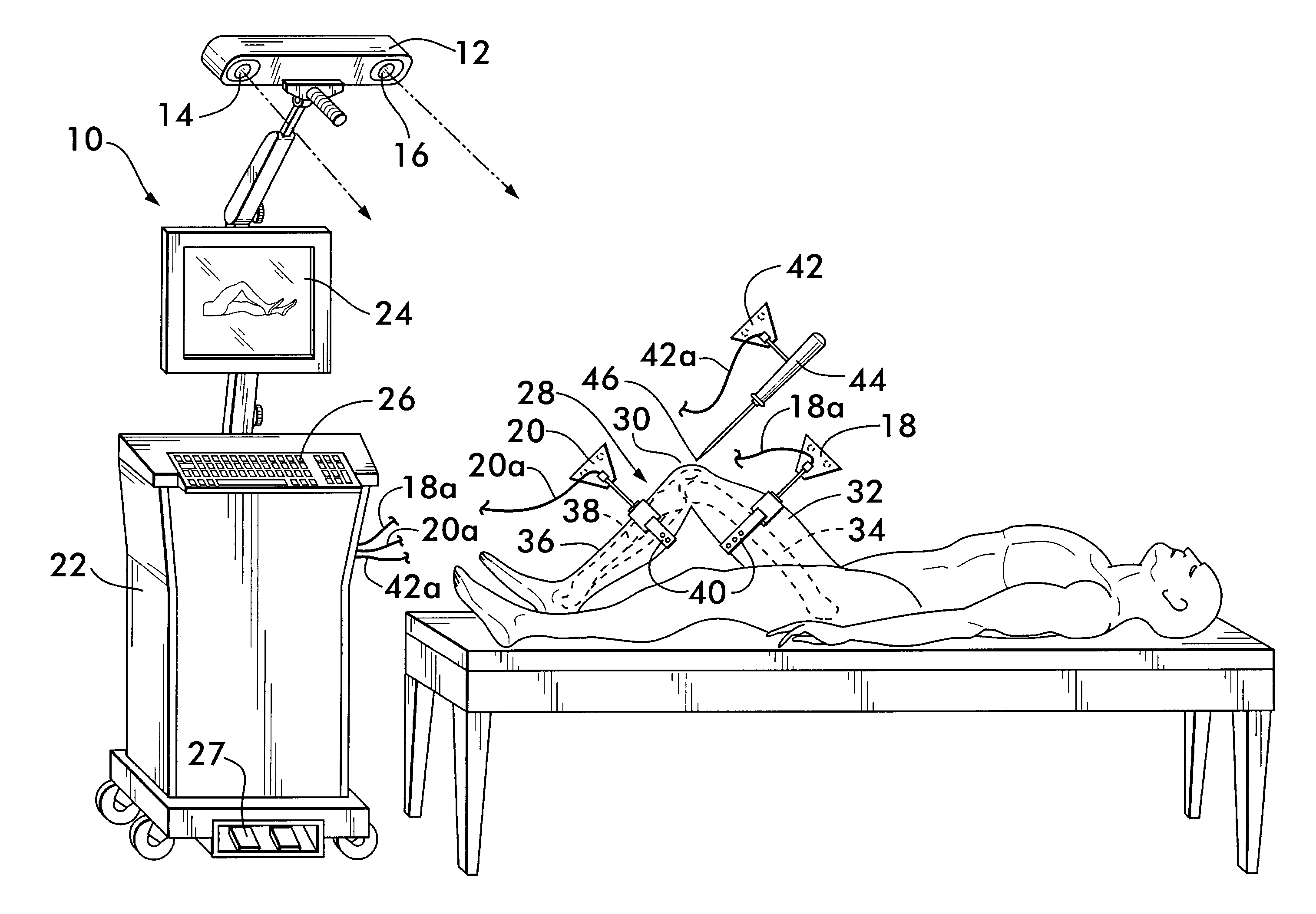 Method of determining the position of the articular point of a joint