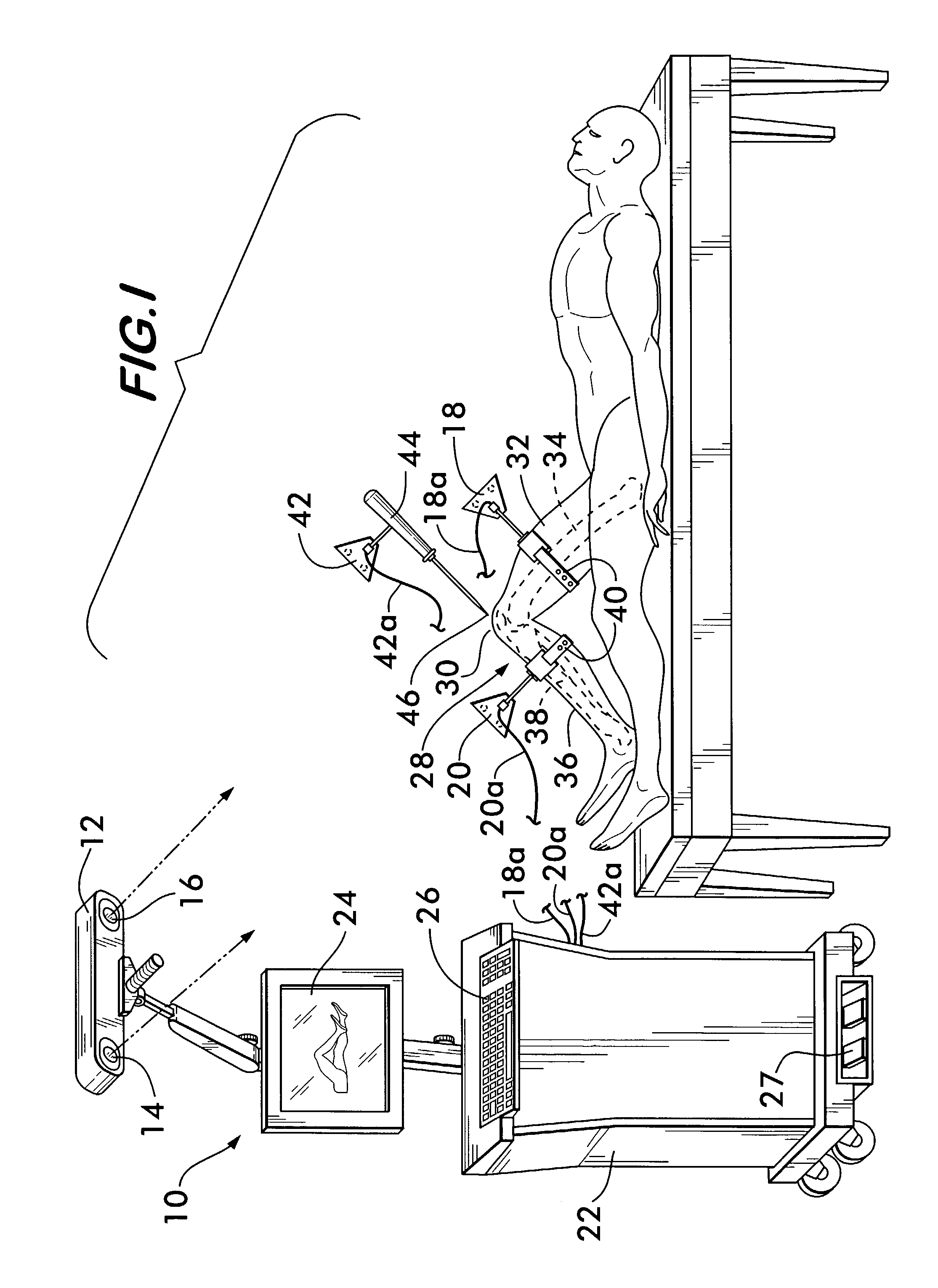 Method of determining the position of the articular point of a joint