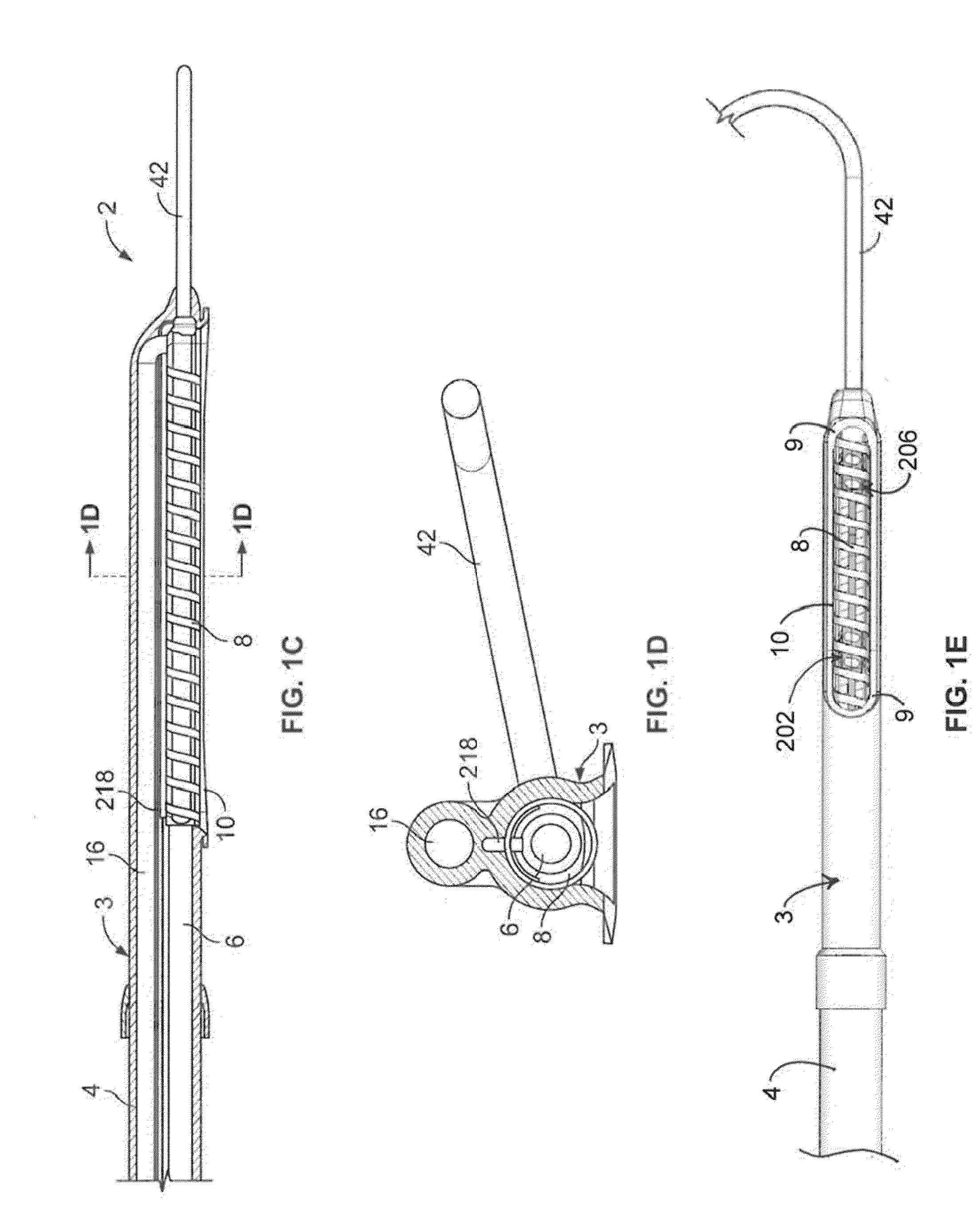 Vacuum coagulation probes