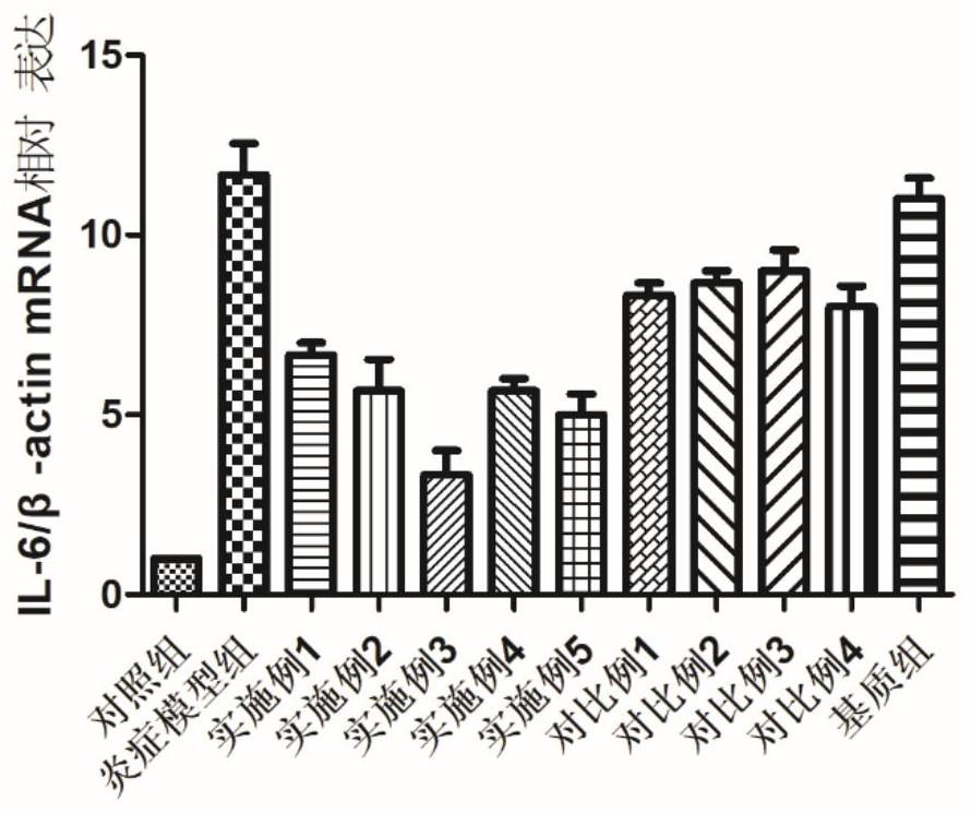 Composition for ophthalmology as well as preparation method and application of composition