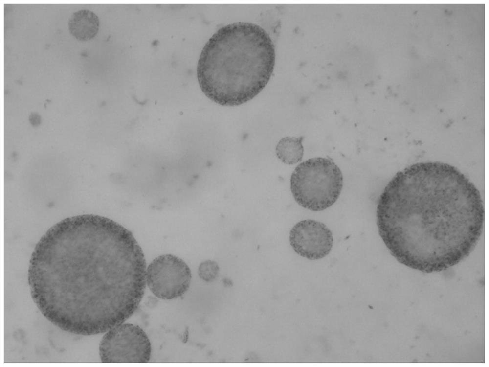 A kind of preparation method of bupivacaine multivesicular liposome and bupivacaine multivesicular liposome preparation