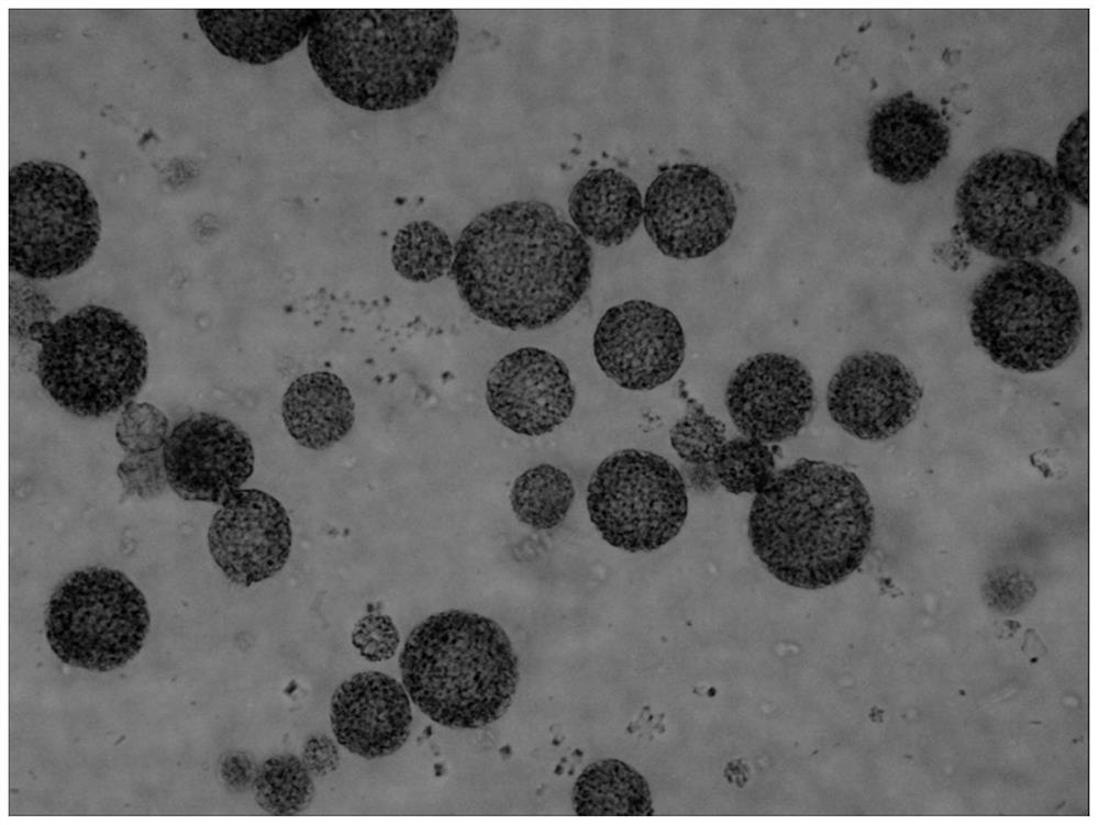 A kind of preparation method of bupivacaine multivesicular liposome and bupivacaine multivesicular liposome preparation