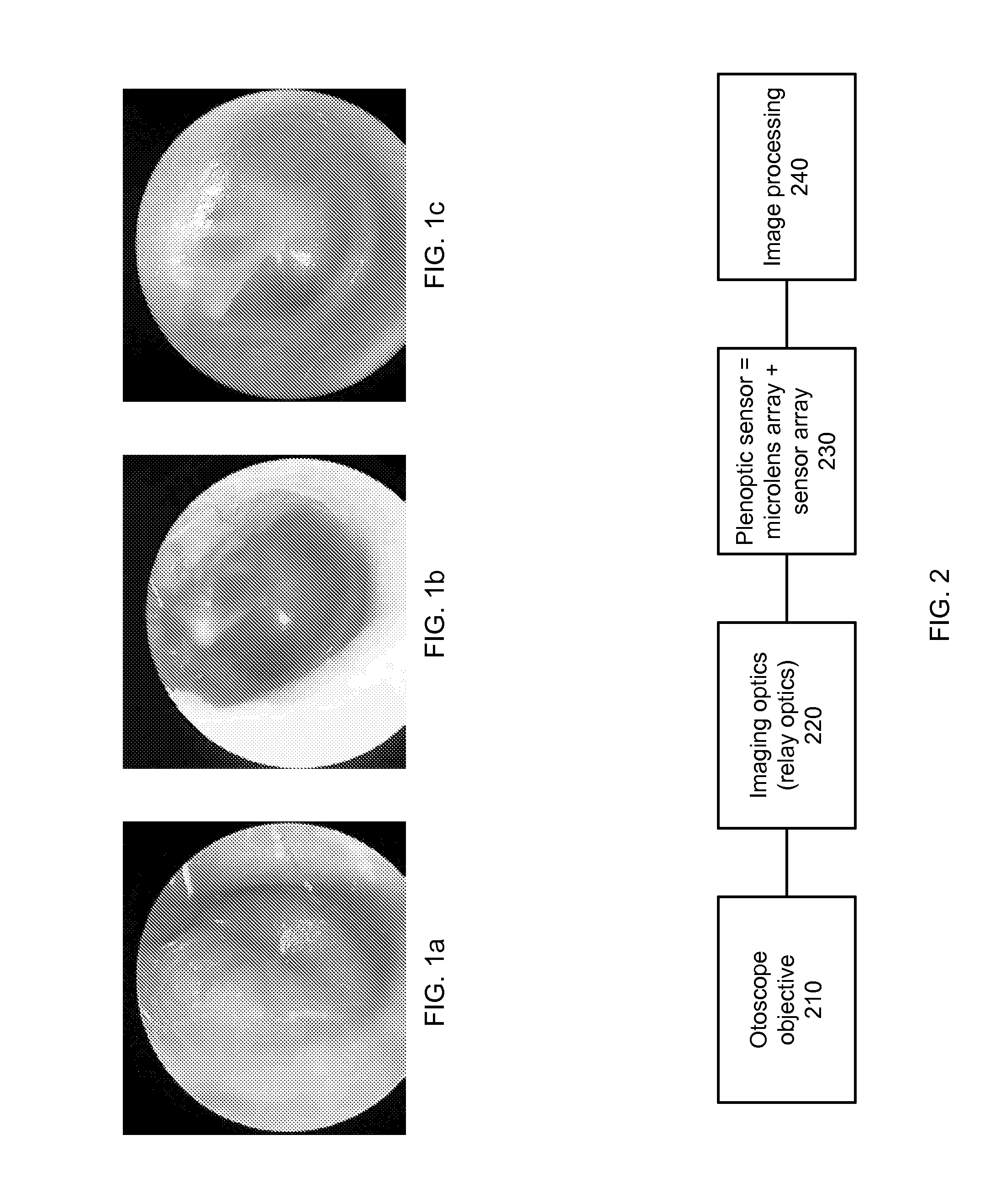 Use of Plenoptic Otoscope Data for Aiding Medical Diagnosis