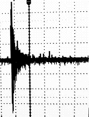 Active noise control system based on variable step LMS algorithm