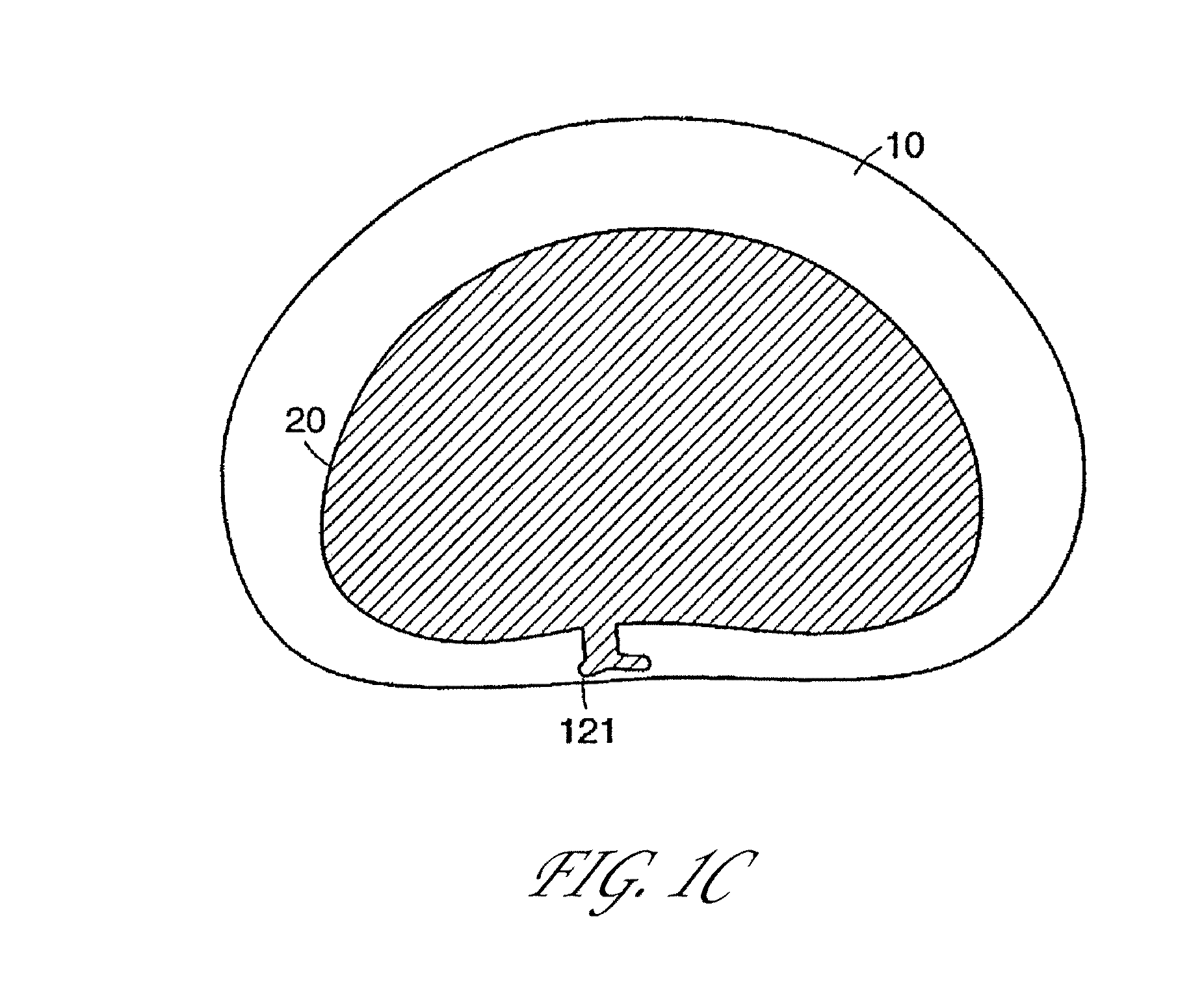 Intervertebral disc reinforcement systems