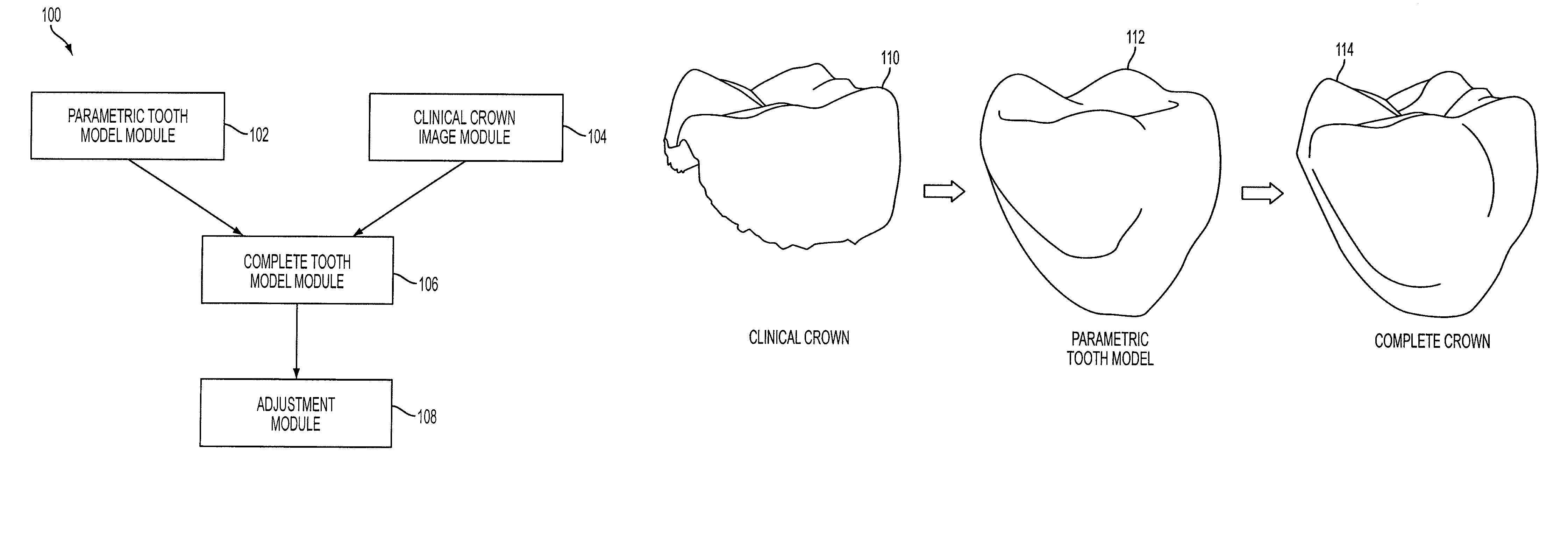 Reconstruction of non-visible part of tooth