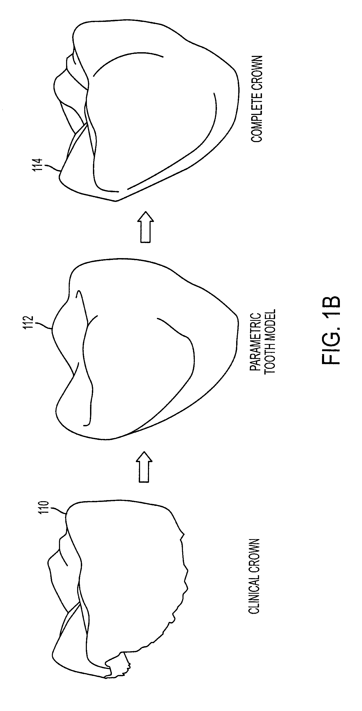 Reconstruction of non-visible part of tooth