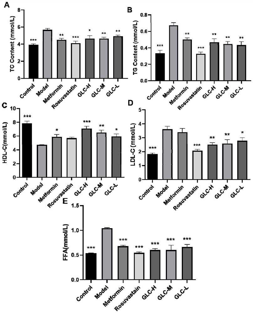 Application of glucosamine in preparation of medicine for treating non-alcoholic fatty liver disease