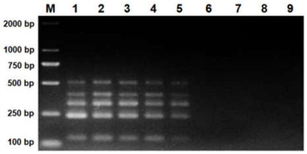 Multiplex pcr rapid diagnostic kit for five kinds of porcine diarrhea virus and its application