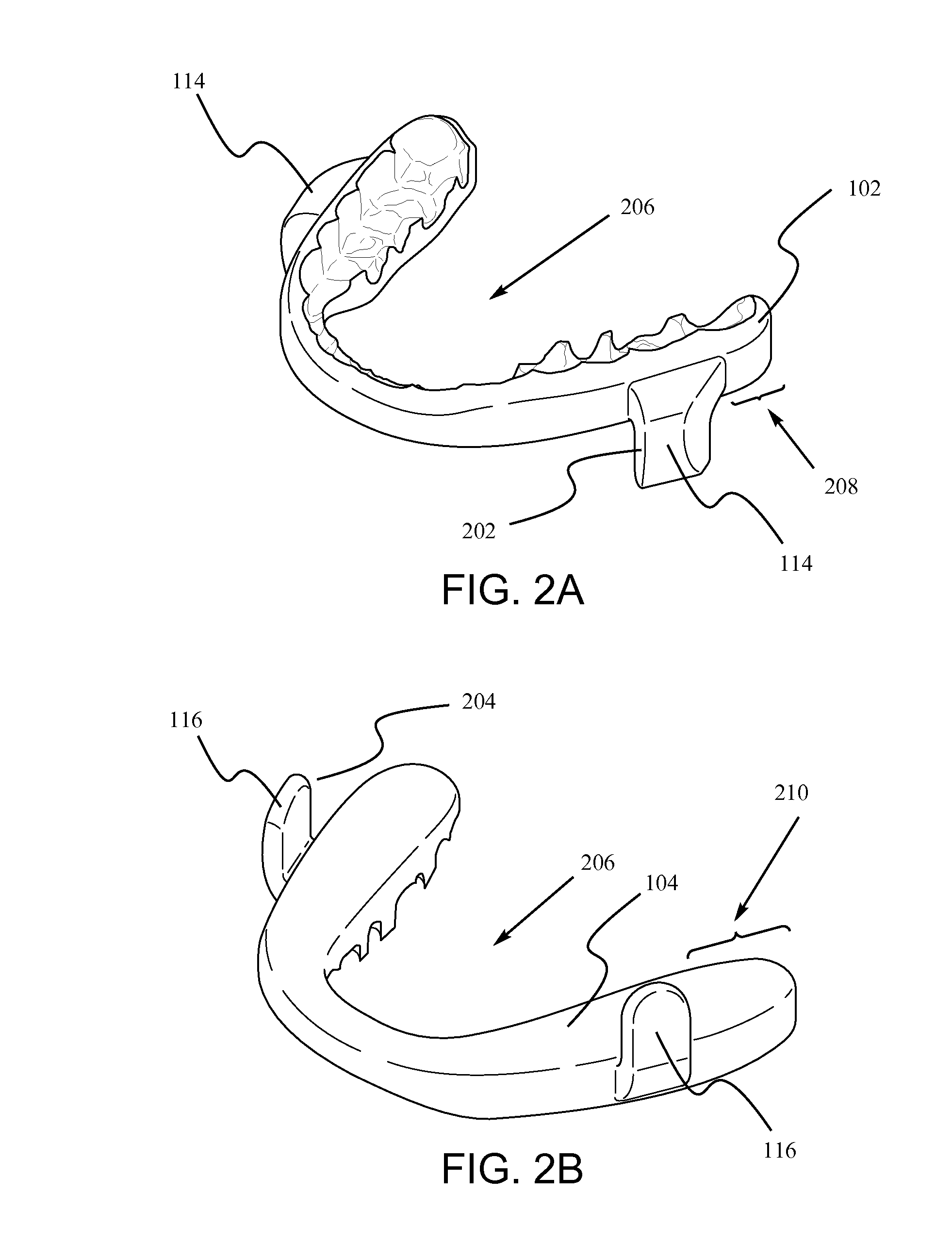 Mandibular advancement device