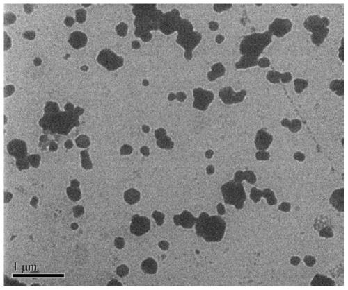 Synthesis method of Systemic Lupus Erythematosus (SLE) treatment nanoparticles