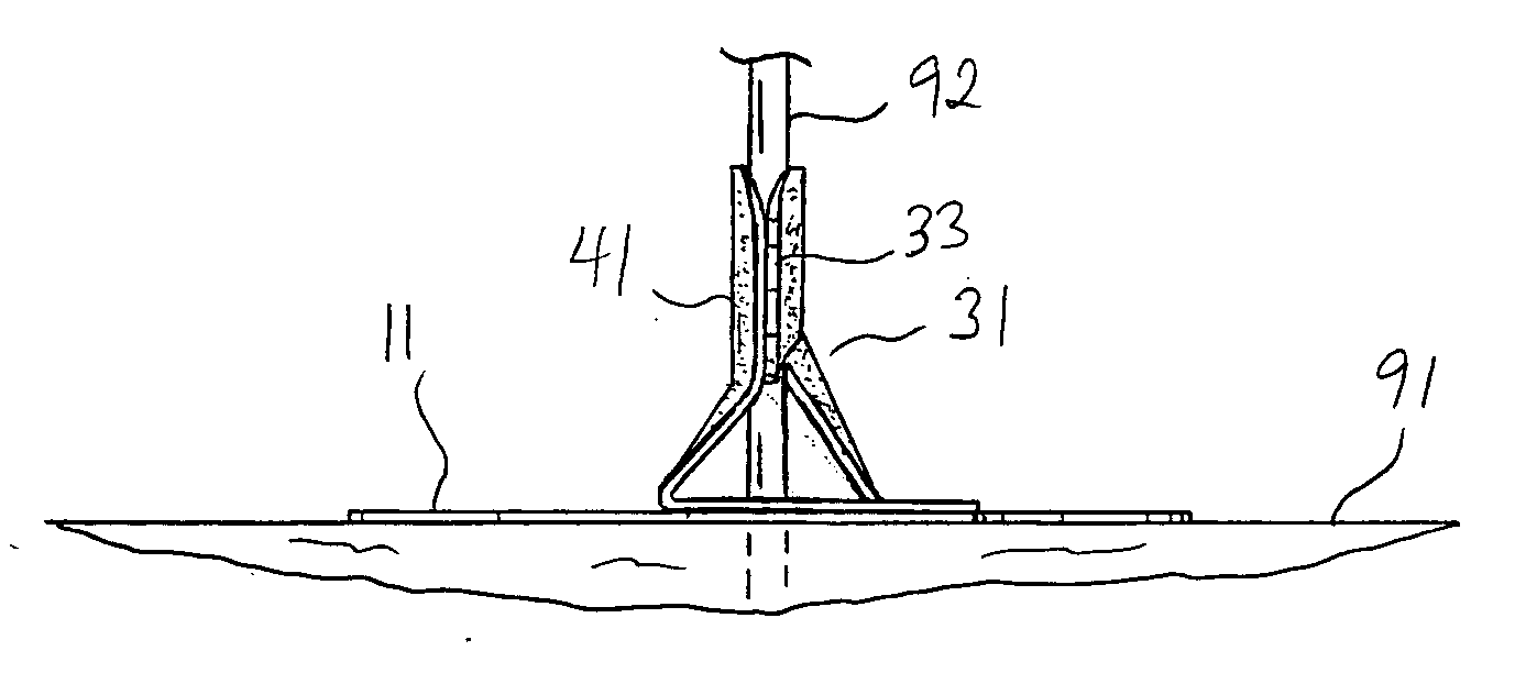 Slotted catheter securement device