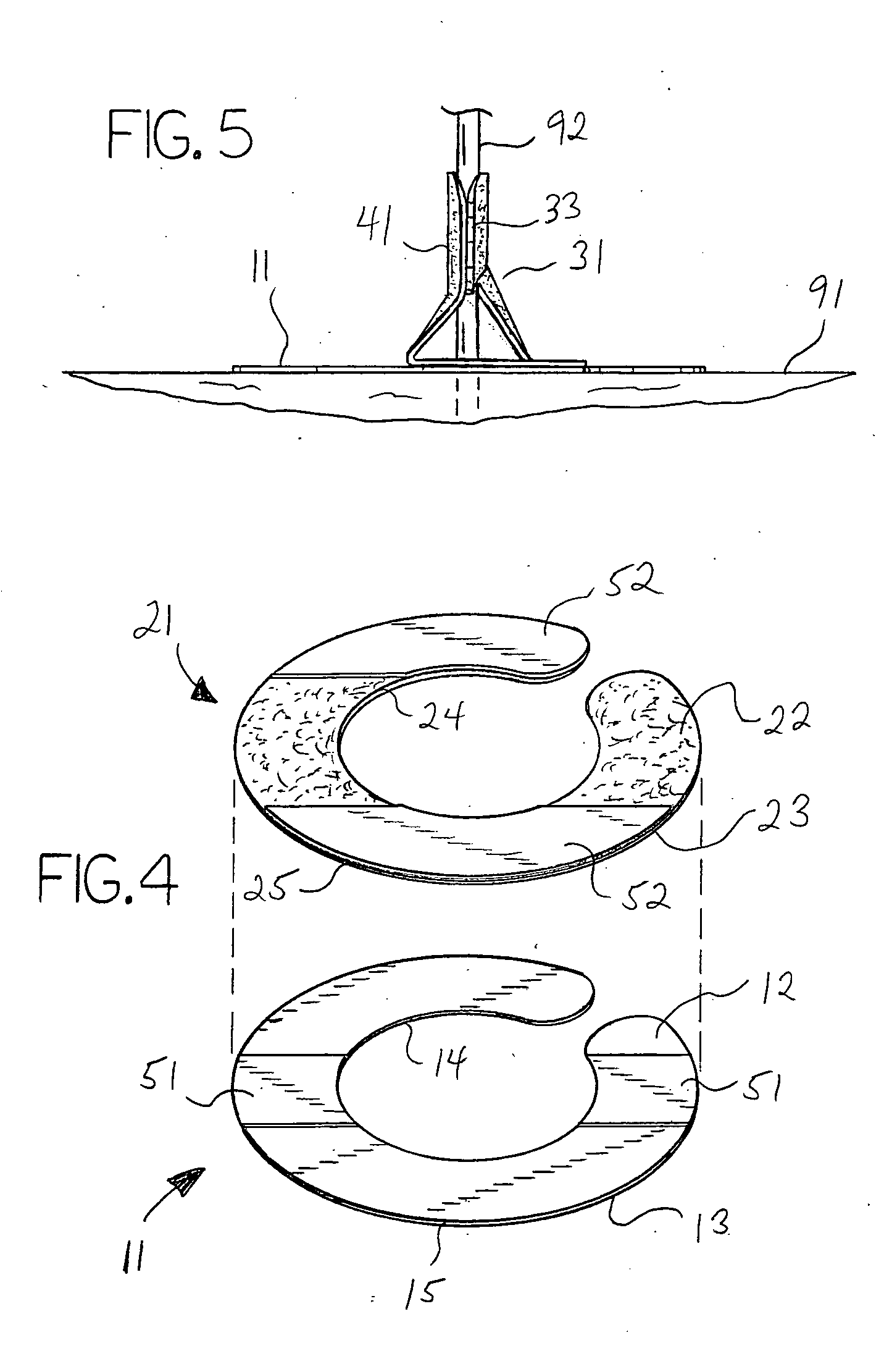 Slotted catheter securement device