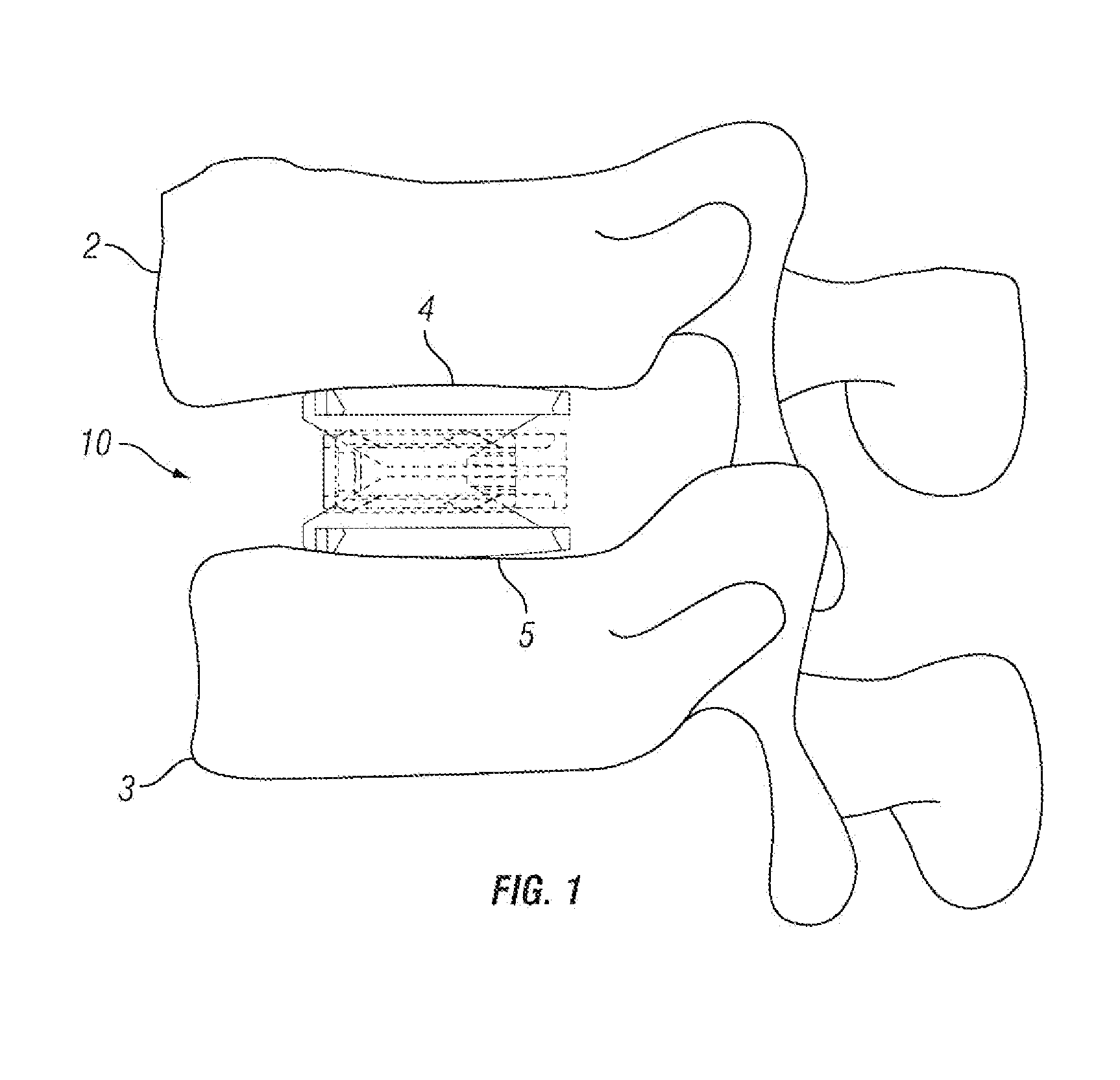 Expandable Fusion Device and Method of Installation Thereof