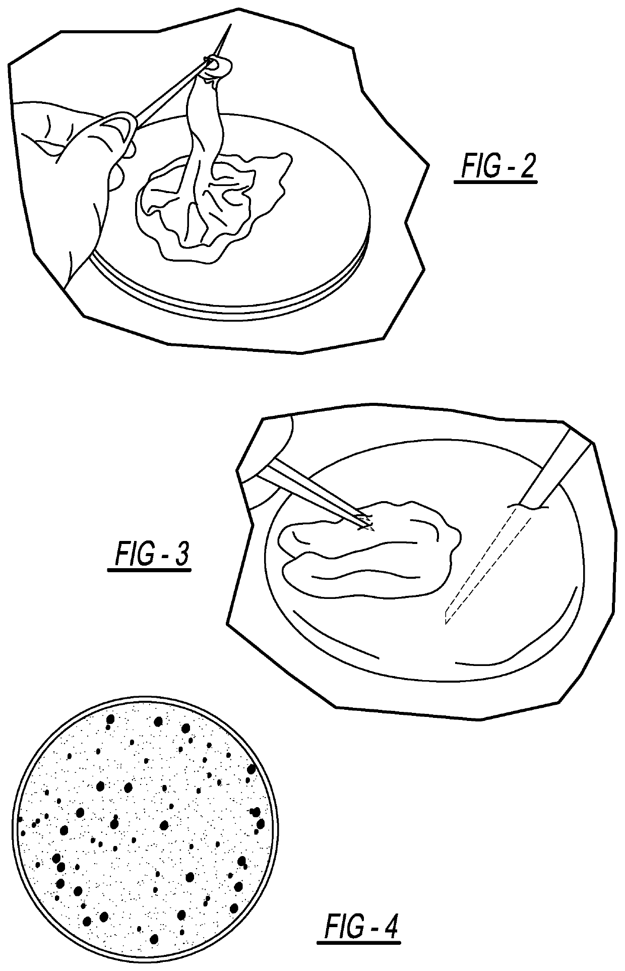 Human umbilical cord blood mesenchymal stem cell transfusion immunotherapy for treatment of cytokine storm associated with coronavirus infection