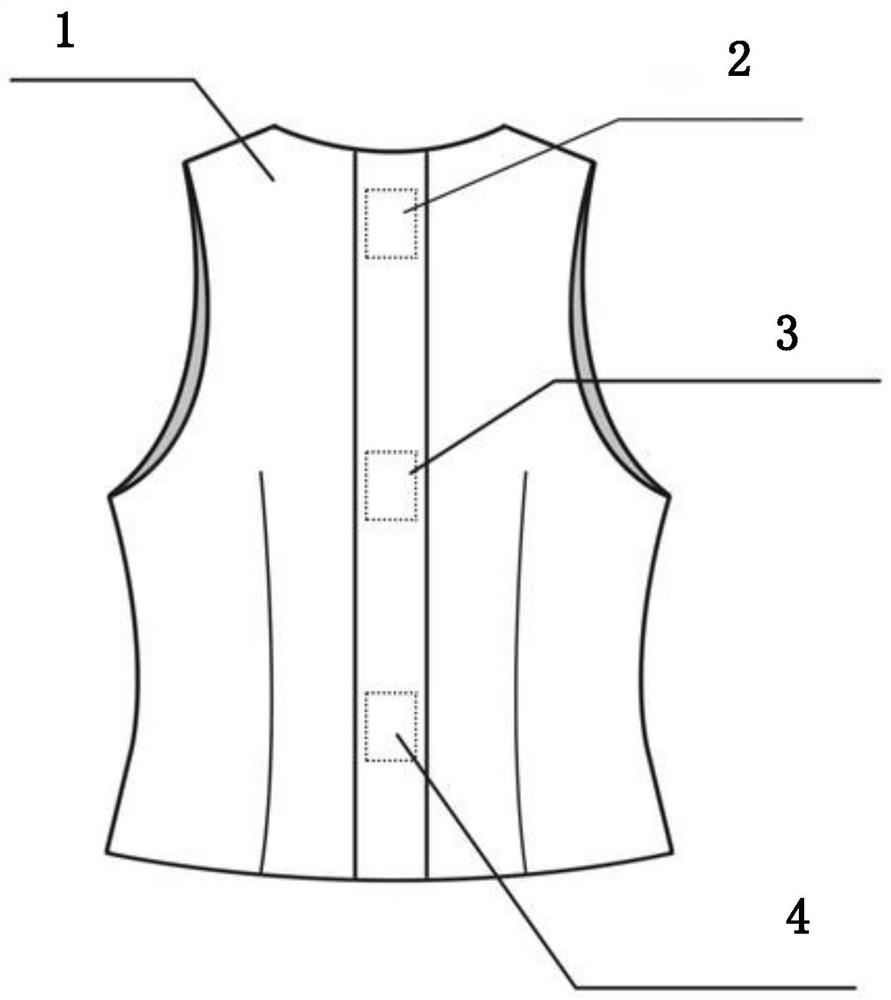 Intelligent spinal curvature monitoring system and method