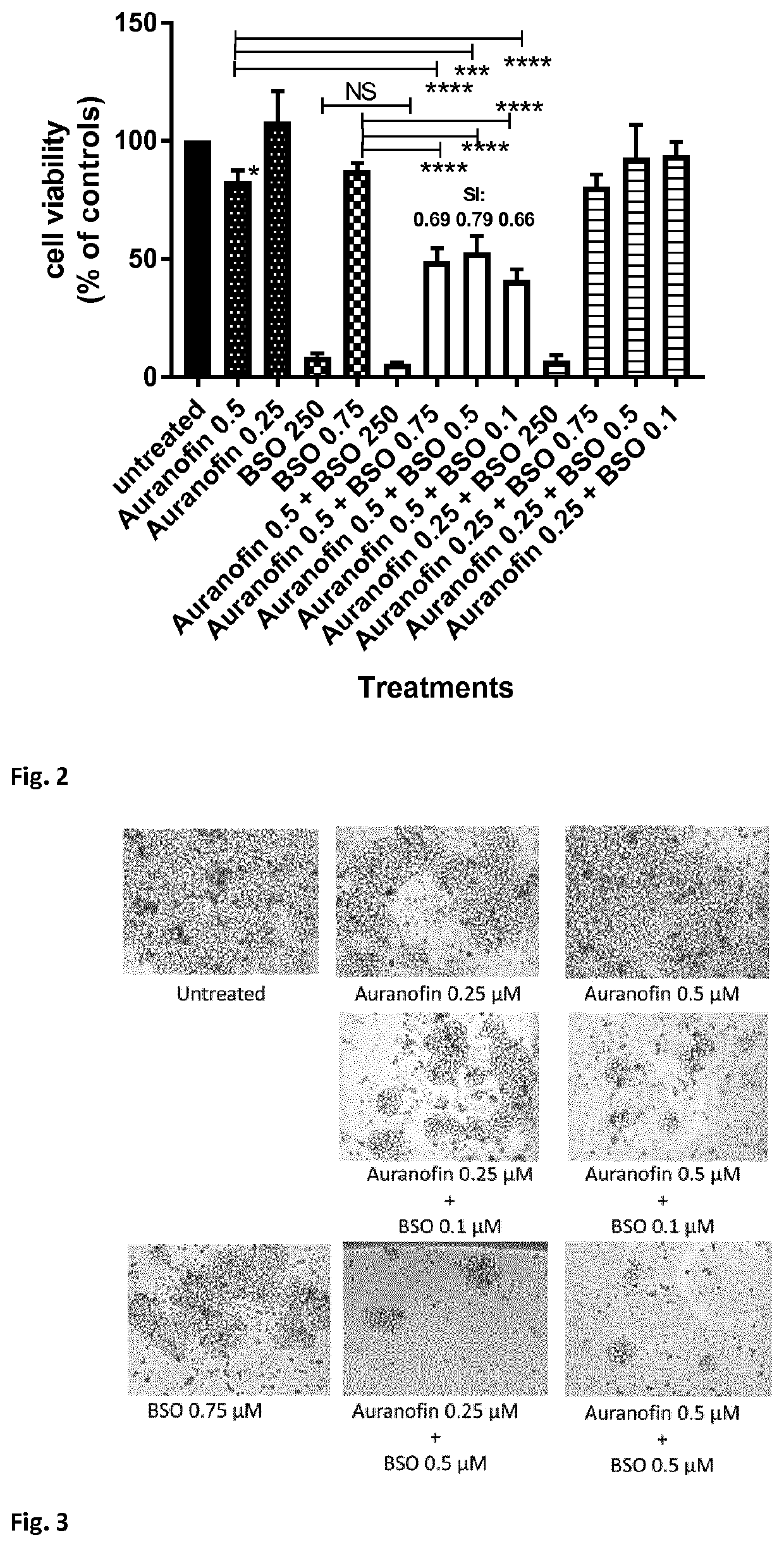 Buthionine sulfoximine and a metallodrug for the treatment of cancer, HIV or a rheumatic disease