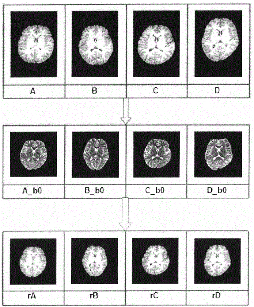 Construction method for health people white matter fiber tract atlas