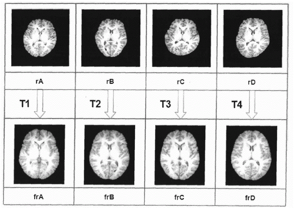 Construction method for health people white matter fiber tract atlas